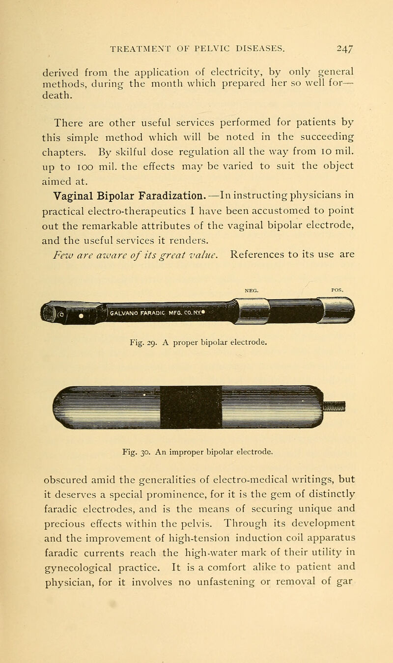 derived from the application of electricity, by only general methods, during the month which prepared her so well for— death. There are other useful services performed for patients by this simple method which will be noted in the succeeding chapters. By skilful dose regulation all the way from 10 mil. up to TOO mil. the effects may be varied to suit the object aimed at. Vaginal Bipolar Faradization.—In instructing physicians in practical electro-therapeutics I have been accustomed to point out the remarkable attributes of the vaginal bipolar electrode, and the useful services it renders. Few are azvare of its great value. References to its use are Fig. 29. A proper bipolar electrode. Fig. 30. An improper bipolar electrode. obscured amid the generalities of electro-medical writings, but it deserves a special prominence, for it is the gem of distinctly faradic electrodes, and is the means of securing unique and precious effects within the pelvis. Through its development and the improvement of high-tension induction coil apparatus faradic currents reach the high-water mark of their utility in gynecological practice. It is a comfort alike to patient and physician, for it involves no unfastening or removal of gar