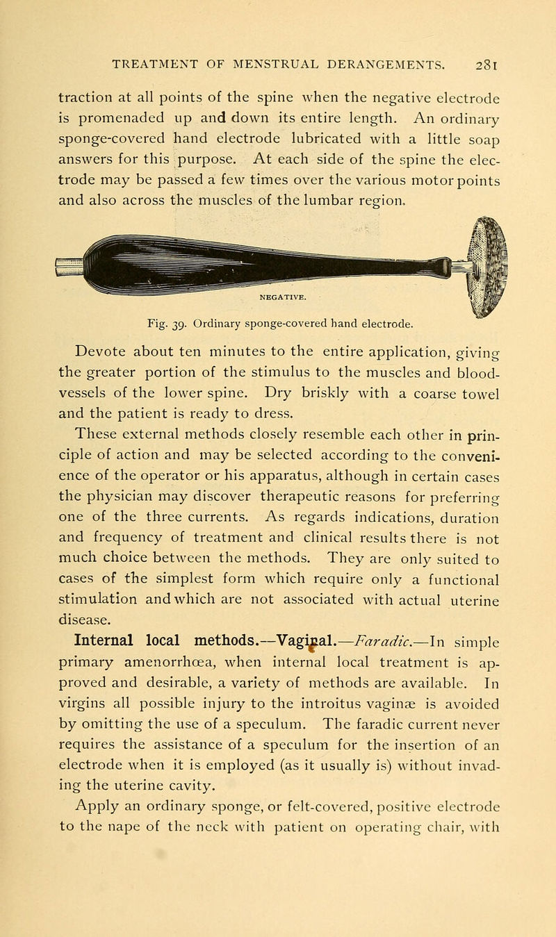 traction at all points of the spine when the negative electrode is promenaded up and down its entire length. An ordinary sponge-covered hand electrode lubricated with a little soap answers for this purpose. At each side of the spine the elec- trode may be passed a few times over the various motor points and also across the muscles of the lumbar region. Fig. 39. Ordinary sponge-covered hand electrode. Devote about ten minutes to the entire application, giving the greater portion of the stimulus to the muscles and blood- vessels of the lower spine. Dry briskly with a coarse towel and the patient is ready to dress. These external methods closely resemble each other in prin- ciple of action and may be selected according to the conveni- ence of the operator or his apparatus, although in certain cases the physician may discover therapeutic reasons for preferring one of the three currents. As regards indications, duration and frequency of treatment and clinical results there is not much choice between the methods. They are only suited to cases of the simplest form which require only a functional stimulation and which are not associated with actual uterine disease. Internal local methods.—Vagi|ial.—Faradic.—ln simple primary amenorrhoea, when internal local treatment is ap- proved and desirable, a variety of methods are available. In virgins all possible injury to the introitus vaginae is avoided by omitting the use of a speculum. The faradic current never requires the assistance of a speculum for the insertion of an electrode when it is employed (as it usually is) without invad- ing the uterine cavity. Apply an ordinary sponge, or felt-covered, positive electrode to the nape of the neck with patient on operating chair, with