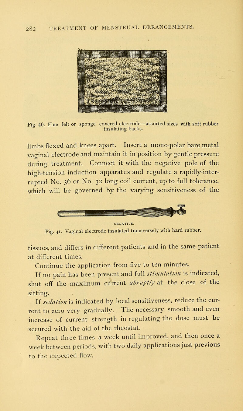 Fig. 40. Fine felt or sponge covered electrode—assorted sizes with soft rubber insulating backs. limbs flexed and knees apart. Insert a mono-polar bare metal vaginal electrode and maintain it in position by gentle pressure during treatment. Connect it with the negative pole of the high-tension induction apparatus and regulate a rapidly-inter- rupted No. 36 or No. 32 long coil current, up to full tolerance, which will be governed by the varying sensitiveness of the NEGATIVE. Fig. 41. Vaginal electrode insulated transversely with hard rubber. tissues, and differs in different patients and in the same patient at different times. Continue the application from five to ten minutes. If no pain has been present and full stimulation is indicated, shut off the maximum current abruptly at the close of the sitting. If sedation is indicated by local sensitiveness, reduce the cur- rent to zero very gradually. The necessary smooth and even increase of current strength in regulating the dose must be secured with the aid of the rheostat. Repeat three times a week until improved, and then once a week between periods, with two daily applications just previous to the expected flow.