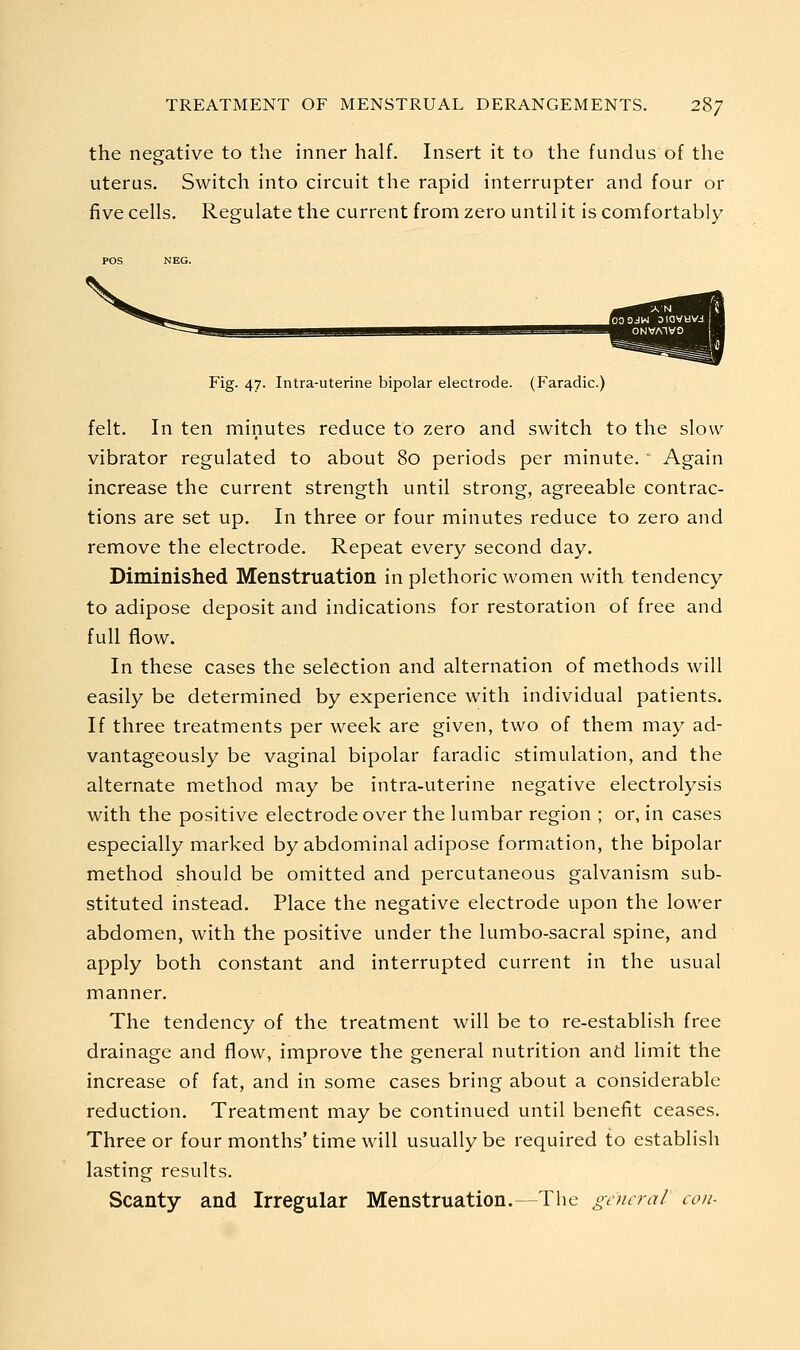 the negative to the inner half. Insert it to the fundus of the uterus. Switch into circuit the rapid interrupter and four or five cells. Regulate the current from zero until it is comfortably ONVA^V0 Fig. 47- Intra-uterine bipolar electrode. (Faradic.) felt. In ten minutes reduce to zero and switch to the slow vibrator regulated to about 80 periods per minute. Again increase the current strength until strong, agreeable contrac- tions are set up. In three or four minutes reduce to zero and remove the electrode. Repeat every second day. Diminished Menstruation in plethoric women with tendency to adipose deposit and indications for restoration of free and full flow. In these cases the selection and alternation of methods will easily be determined by experience with individual patients. If three treatments per week are given, two of them may ad- vantageously be vaginal bipolar faradic stimulation, and the alternate method may be intra-uterine negative electrolysis with the positive electrode over the lumbar region ; or, in cases especially marked by abdominal adipose formation, the bipolar method should be omitted and percutaneous galvanism sub- stituted instead. Place the negative electrode upon the lower abdomen, with the positive under the lumbo-sacral spine, and apply both constant and interrupted current in the usual manner. The tendency of the treatment will be to re-establish free drainage and flow, improve the general nutrition and limit the increase of fat, and in some cases bring about a considerable reduction. Treatment may be continued until benefit ceases. Three or four months'time will usually be required to establish lasting results. Scanty and Irregular Menstruation.—The general con-