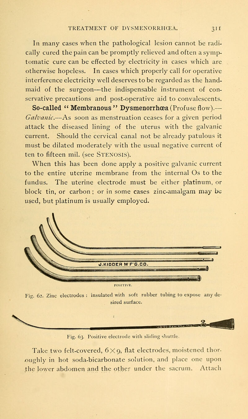 In many cases when the pathological lesion cannot be radi- cally cured the pain can be promptly relieved and often a symp- tomatic cure can be effected by electricity in cases which are otherwise hopeless. In cases which properly call for operative interference electricity well deserves to be regarded as the hand- maid of the surgeon—the indispensable instrument of con- servative precautions and post-operative aid to convalescents. So-called Membranous Dysmenorrhcea(Profuseflow).— Galvanic.—As soon as menstruation ceases for a given period attack the diseased lining of the uterus with the galvanic current. Should the cervical canal not be already patulous it must be dilated moderately with the usual negative current of ten to fifteen mil. (see STENOSIS). When this has been done apply a positive galvanic current to the entire uterine membrane from the internal Os to the fundus. The uterine electrode must be either platinum, or block tin, or carbon ; or in some cases zinc-amalgam may be used, but platinum is usually employed. Fi<'. 62. Zinc electrodes : insulated with soft rubber tubing to expose any de- sired surface. Fig. 63. Positive electrode with sliding shuttle. Take two felt-covered, 6X9, flat electrodes, moistened thor- oughly in hot soda-bicarbonate solution, and place one upon the lower abdomen and the other under the sacrum. Attach