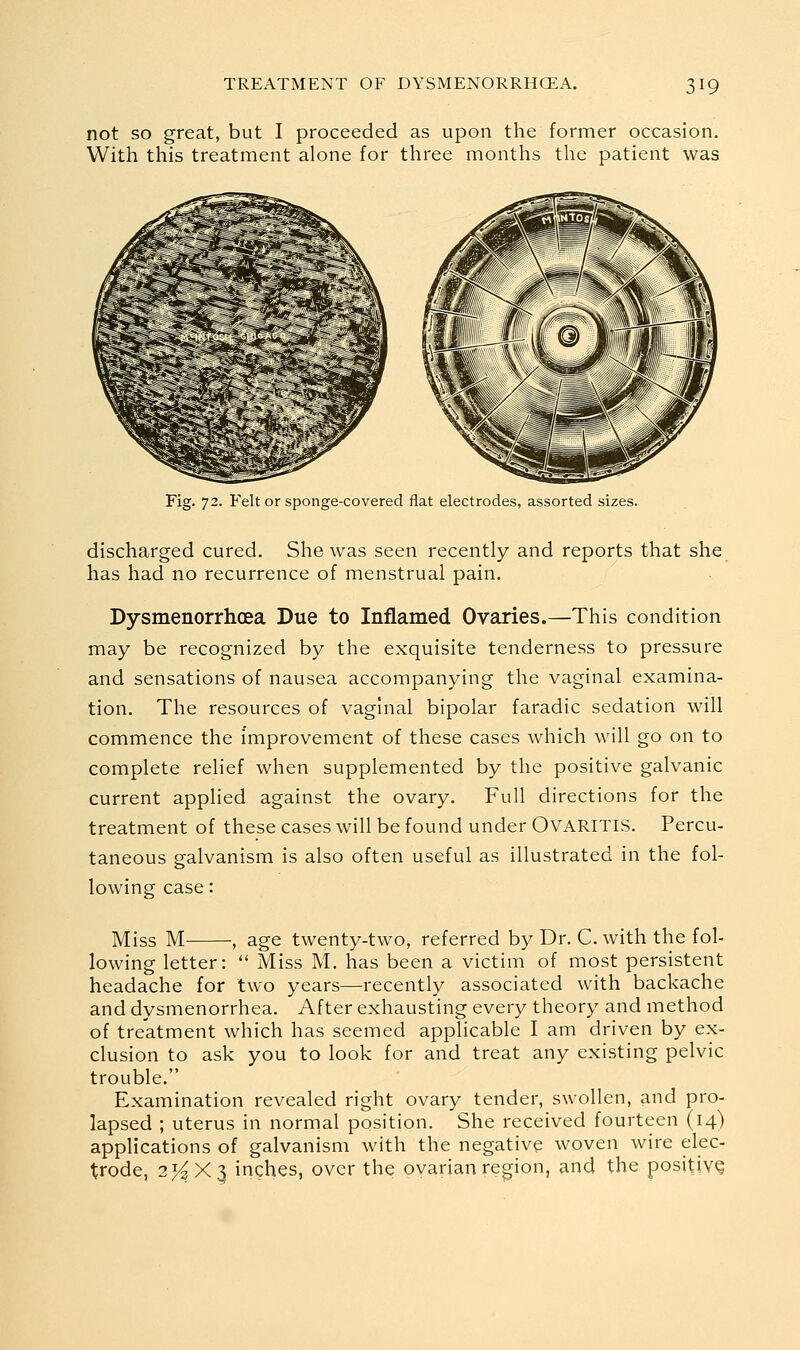 not so great, but I proceeded as upon the former occasion. With this treatment alone for three months the patient was Fig. 72. Felt or sponge-covered flat electrodes, assorted sizes. discharged cured. She was seen recently and reports that she has had no recurrence of menstrual pain. Dysmenorrhcea Due to Inflamed Ovaries.—This condition may be recognized by the exquisite tenderness to pressure and sensations of nausea accompanying the vaginal examina- tion. The resources of vagnial bipolar faradic sedation will commence the improvement of these cases which will go on to complete relief when supplemented by the positive galvanic current applied against the ovary. Full directions for the treatment of these cases will be found under OVARITIS. Percu- taneous galvanism is also often useful as illustrated in the fol- lowing case: Miss M , age twenty-two, referred by Dr. C. with the fol- lowing letter:  Miss M. has been a victim of most persistent headache for two years—recently associated with backache and dysmenorrhea. After exhausting every theory and method of treatment which has seemed applicable I am driven by ex- clusion to ask you to look for and treat any existing pelvic trouble. Examination revealed right ovary tender, swollen, and pro- lapsed ; uterus in normal position. She received fourteen (14) applications of galvanism with the negative woven wire elec- trode, 2^X3 inches, over the ovarian region, and the positive