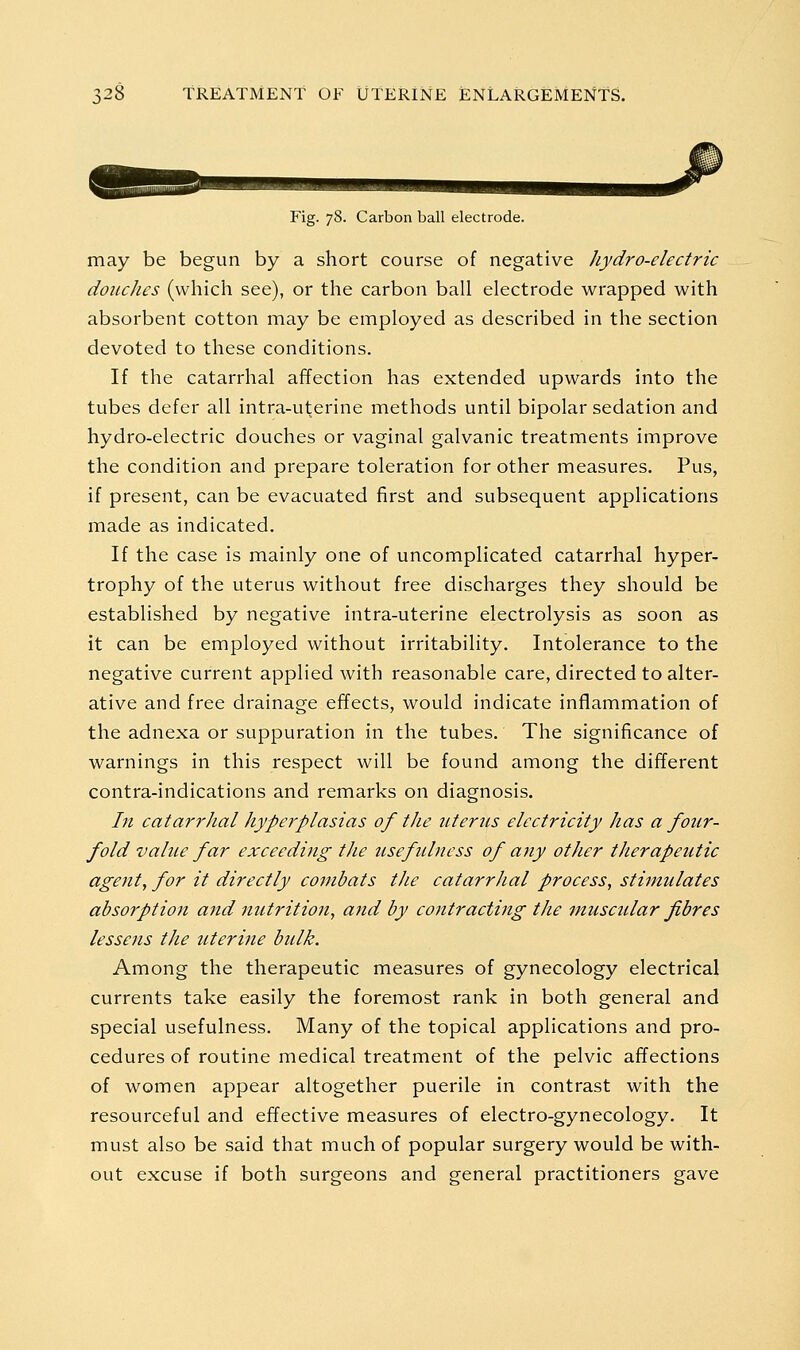 Fig. 78. Carbon ball electrode. may be begun by a short course of negative hydro-electric douches (which see), or the carbon ball electrode wrapped with absorbent cotton may be employed as described in the section devoted to these conditions. If the catarrhal affection has extended upwards into the tubes defer all intra-uterine methods until bipolar sedation and hydro-electric douches or vaginal galvanic treatments improve the condition and prepare toleration for other measures. Pus, if present, can be evacuated first and subsequent applications made as indicated. If the case is mainly one of uncomplicated catarrhal hyper- trophy of the uterus without free discharges they should be established by negative intra-uterine electrolysis as soon as it can be employed without irritability. Intolerance to the negative current applied with reasonable care, directed to alter- ative and free drainage effects, would indicate inflammation of the adnexa or suppuration in the tubes. The significance of warnings in this respect will be found among the different contra-indications and remarks on diagnosis. Lt catarrhal hyperplasias of the uterus electricity has a four- fold value far exceeding the usefulness of any other therapeutic agent, for it directly combats the catarrhal process, stimulates absorption and nutrition, and by co7ttracting the muscular fibres lessens the uterine bulk. Among the therapeutic measures of gynecology electrical currents take easily the foremost rank in both general and special usefulness. Many of the topical applications and pro- cedures of routine medical treatment of the pelvic affections of women appear altogether puerile in contrast with the resourceful and effective measures of electro-gynecology. It must also be said that much of popular surgery would be with- out excuse if both surgeons and general practitioners gave