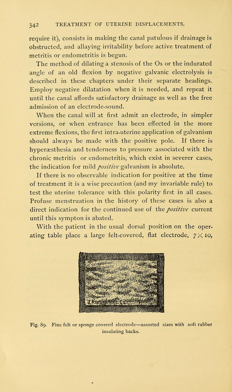 require it), consists in making the canal patulous if drainage is obstructed, and allaying irritability before active treatment of metritis or endometritis is begun. The method of dilating a stenosis of the Os or the indurated angle of an old flexion by negative galvanic electrolysis is described in these chapters under their separate headings. Employ negative dilatation when it is needed, and repeat it until the canal affords satisfactory drainage as well as the free admission of an electrode-sound. When the canal will at first admit an electrode, in simpler versions, or when entrance has been effected in the more extreme flexions, the first intra-uterine application of galvanism should always be made with the positive pole. If there is hyperaesthesia and tenderness to pressure associated with the chronic metritis or endometritis, which exist in severer cases, the indication for mild positive galvanism is absolute. If there is no observable indication for positive at the time of treatment it is a wise precaution (and my invariable rule) to test the uterine tolerance with this polarity first in all cases. Profuse menstruation in the history of these cases is also a direct indication for the continued use of X^ao. positive current until this sympton is abated. With the patient in the usual dorsal position on the oper- ating table place a large felt-covered, flat electrode, 7X 10, Fig. 89. Fine felt or sponge covered electrode—assorted sizes with soft rubber insulating backs.