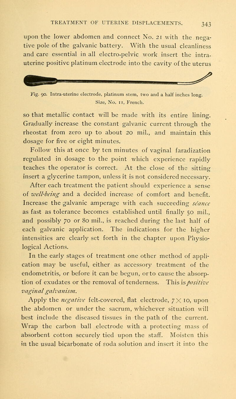 upon the lower abdomen and connect No. 21 with the nega- tive pole of the galvanic battery. With the usual cleanliness and care essential in all electro-pelvic work insert the intra- uterine positive platinum electrode into the cavity of the uterus Fig. 90. Intra-uterine electrode, platinum stem, two and a half inches long. Size, No. II, French. so that metallic contact will be made with its entire lining. Gradually increase the constant galvanic current through the rheostat from zero up to about 20 mil., and maintain this dosage for five or eight minutes. Follow this at once by ten minutes of vaginal faradization regulated in dosage to the point which experience rapidly teaches the operator is correct. At the close of the sitting insert a glycerine tampon, unless it is not considered necessary. After each treatment the patient should experience a sense of well-being and a decided increase of comfort and benefit. Increase the galvanic amperage with each succeeding seance as fast as tolerance becomes established until finally 50 mil., and possibly 70 or 80 mil., is reached during the last half of each galvanic application. The indications for the higher intensities are clearly set forth in the chapter upon Physio- logical Actions. In the early stages of treatment one other method of appli- cation may be useful, either as accessory treatment of the endometritis, or before it can be begun, or to cause the absorp- tion of exudates or the removal of tenderness. This \^positive vaginal galvanism. Apply the negative felt-covered, flat electrode, /X 10, upon the abdomen or under the sacrum, whichever situation will best include the diseased tissues in the path of the current. Wrap the carbon ball electrode with a protecting mass of absorbent cotton securely tied upon the staff. Moisten this in the usual bicarbonate of soda solution and insert it into the