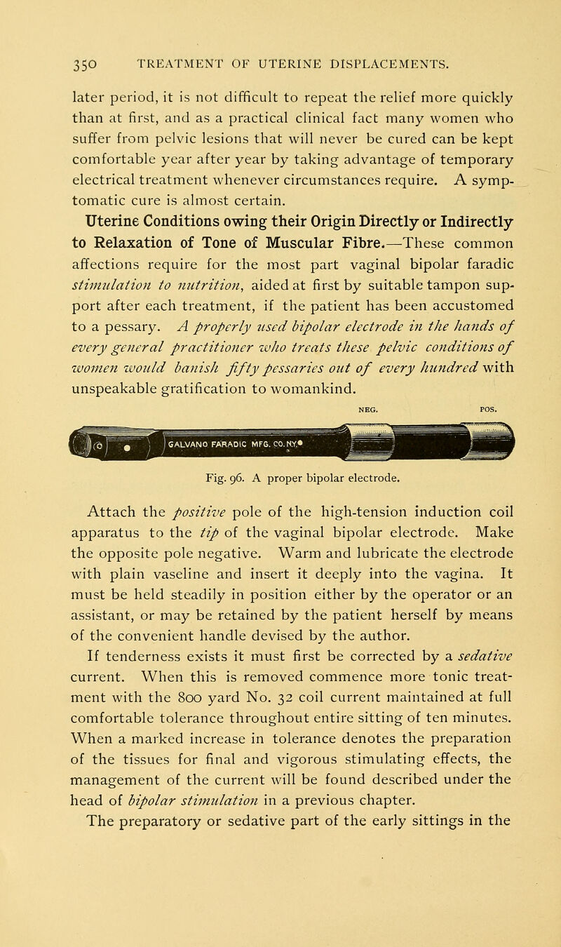 later period, it is not difficult to repeat the relief more quickly than at first, and as a practical clinical fact many women who suffer from pelvic lesions that will never be cured can be kept comfortable year after year by taking advantage of temporary electrical treatment whenever circumstances require. A symp- tomatic cure is almost certain. Uterine Conditions owing their Origin Directly or Indirectly to Relaxation of Tone of Muscular Fibre.—These common affections require for the most part vaginal bipolar faradic stimulation to nutrition, aided at first by suitable tampon sup- port after each treatment, if the patient has been accustomed to a pessary. A properly used bipolar electrode in the Jiands of every general practitioner who treats these pelvic conditions of zvomen zuould banisJi fifty pessaries out of every hundred with unspeakable gratification to womankind. Fig. 96. A proper bipolar electrode. Attach the positive pole of the high-tension induction coil apparatus to the tip of the vaginal bipolar electrode. Make the opposite pole negative. Warm and lubricate the electrode with plain vaseline and insert it deeply into the vagina. It must be held steadily in position either by the operator or an assistant, or may be retained by the patient herself by means of the convenient handle devised by the author. If tenderness exists it must first be corrected by a sedative current. When this is removed commence more tonic treat- ment with the 800 yard No. 32 coil current maintained at full comfortable tolerance throughout entire sitting of ten minutes. When a marked increase in tolerance denotes the preparation of the tissues for final and vigorous stimulating effects, the management of the current will be found described under the head of bipolar stimulation in a previous chapter. The preparatory or sedative part of the early sittings in the