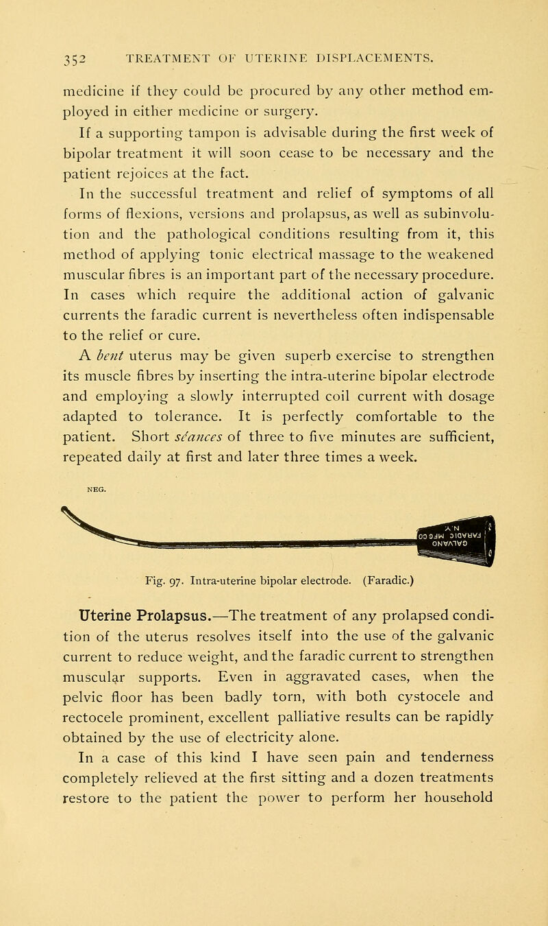 medicine if they could be procured by any other method em- ployed in either medicine or surgery. If a supporting tampon is advisable during the first week of bipolar treatment it will soon cease to be necessary and the patient rejoices at the fact. In the successful treatment and relief of symptoms of all forms of flexions, versions and prolapsus, as well as subinvolu- tion and the pathological conditions resulting from it, this method of applying tonic electrical massage to the weakened muscular fibres is an important part of the necessary procedure. In cases which require the additional action of galvanic currents the faradic current is nevertheless often indispensable to the relief or cure. A hent uterus may be given superb exercise to strengthen its muscle fibres by inserting the intra-uterine bipolar electrode and employing a slowly interrupted coil current with dosage adapted to tolerance. It is perfectly comfortable to the patient. Short stances of three to five minutes are sufficient, repeated daily at first and later three times a week. i^ssmm Fig. 97. Intra-uterine bipolar electrode. (Faradic.) Uterine Prolapsus.—The treatment of any prolapsed condi- tion of the uterus resolves itself into the use of the galvanic current to reduce weight, and the faradic current to strengthen musculg.r supports. Even in aggravated cases, when the pelvic floor has been badly torn, with both cystocele and rectocele prominent, excellent palliative results can be rapidly obtained by the use of electricity alone. In a case of this kind I have seen pain and tenderness completely relieved at the first sitting and a dozen treatments restore to the patient the power to perform her household