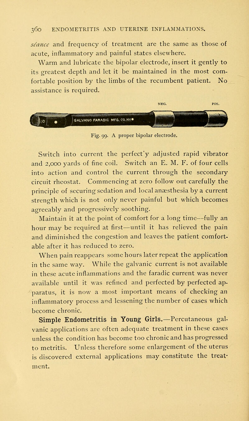 seance and frequency of treatment are the same as those of acute, inflammatory and painful states elsewhere. Warm and lubricate the bipolar electrode, insert it gently to its greatest depth and let it be maintained in the most com- fortable position by the limbs of the recumbent patient. No assistance is required. Fig. 99. A proper bipolar electrode. Switch into current the perfect'y adjusted rapid vibrator and 2,000 yards of fine coil. Switch an E. M. F. of four cells into action and control the current through the secondary circuit rheostat. Commencing at zero follow out carefully the principle of securing sedation and local anaesthesia by a current strength which is not only never painful but which becomes agreeably and progressively soothing. Maintain it at the point of comfort for a long time—fully an hour may be required at first—until it has relieved the pain and diminished the congestion and leaves the patient comfort- able after it has reduced to zero. When pain reappears some hours later repeat the application in the same way. While the galvanic current is not available in these acute inflammations and the faradic current was never available until it was refined and perfected by perfected ap- paratus, it is now a most important means of checking an inflammatory process and lessening the number of cases which become chronic. Simple Endometritis in Young Giris.—Percutaneous gal- vanic applications are often adequate treatment in these cases unless the condition has become too chronic and has progressed to metritis. Unless therefore some enlargement of the uterus is discovered external applications may constitute the treat- ment.