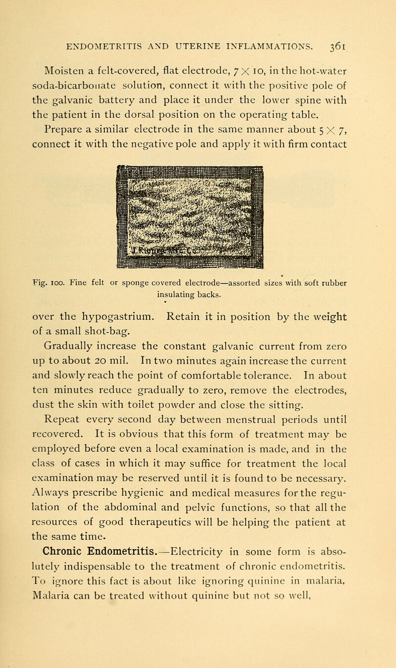 Moisten a felt-covered, flat electrode, 7X 10, in the hot-water soda-bicarbonate solution, connect it with the positive pole of the galvanic battery and place it under the lower spine with the patient in the dorsal position on the operating table. Prepare a similar electrode in the same manner about 5X7, connect it with the negative pole and apply it with firm contact Fig. 100. Fine felt or sponge covered electrode—assorted sizes with soft rubber insulating backs. over the hypogastrium. Retain it in position by the weight of a small shot-bag. Gradually increase the constant galvanic current from zero up to about 20 mil. In two minutes again increase the current and slowly reach the point of comfortable tolerance. In about ten minutes reduce gradually to zero, remove the electrodes, dust the skin with toilet powder and close the sitting. Repeat every second day between menstrual periods until recovered. It is obvious that this form of treatment may be employed before even a local examination is made, and in the class of cases in which it may sufifice for treatment the local examination may be reserved until it is found to be necessary. Always prescribe hygienic and medical measures for the regu- lation of the abdominal and pelvic functions, so that all the resources of good therapeutics will be helping the patient at the same time. Chronic Endometritis.—Electricity in some form is abso- lutely indispensable to the treatment of chronic endometritis. To ignore this fact is about like ignoring quinine in malaria. Malaria can be treated without quinine but not so well,