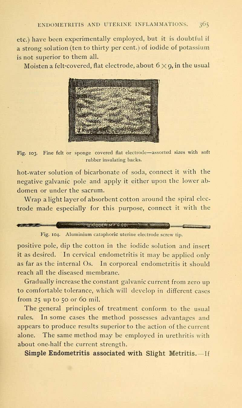 etc.) have been experimentally employed, but it is doubtful if a strong solution (ten to thirty per cent.) of iodide of potassium is not superior to them all. Moisten a felt-covered, fiat electrode, about 6 X9, in the usual Fig. 103. Fine felt or sponge covered flat electrode—assorted sizes with soft rubber insulating backs. hot-water solution of bicarbonate of soda, connect it with the negative galvanic pole and apply it either upon the lower ab- domen or under the sacrum. Wrap alight layer of absorbent cotton around the spiral elec- trode made especially for this purpose, connect it with the Fig. 104. Aluminium cataphoric uterine electrode screw tip. positive pole, dip the cotton in the iodide solution and insert it as desired. In cervical endometritis it may be applied only as far as the internal Os. In corporeal endometritis it should reach all the diseased membrane. Gradually increase the constant galvanic current from zero up to comfortable tolerance, which will develop in different cases from 25 up to 50 or 60 mil. The general principles of treatment conform to the usual rules. In some cases the method possesses advantages and appears to produce results superior to the action of the current alone. The same method may be employed in urethritis with about one-half the current strength. Simple Endometritis associated with Slight Metritis. —If