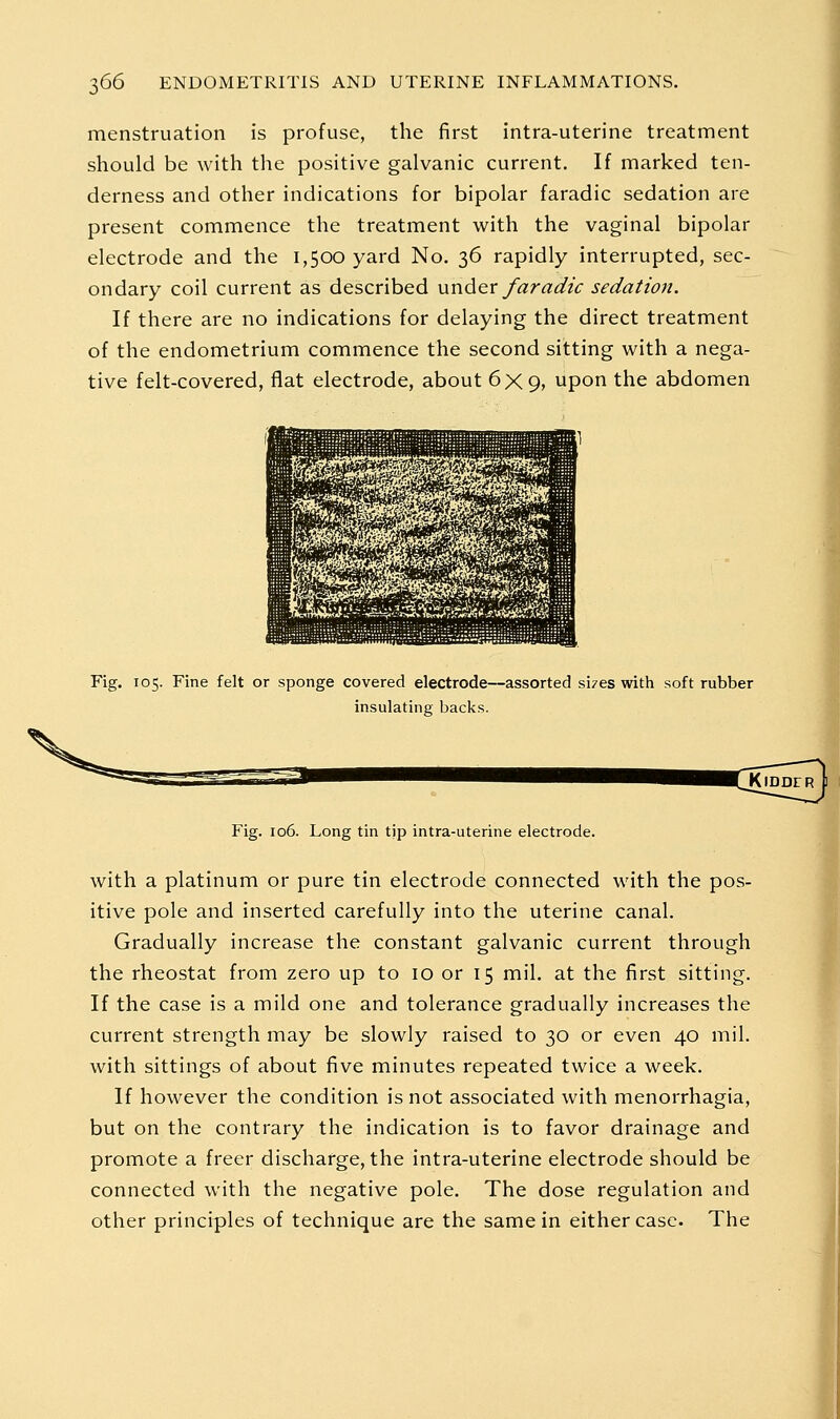 menstruation is profuse, the first intra-uterine treatment should be with the positive galvanic current. If marked ten- derness and other indications for bipolar faradic sedation are present commence the treatment with the vaginal bipolar electrode and the 1,500 yard No. 36 rapidly interrupted, sec- ondary coil current as described under faradic sedation. If there are no indications for delaying the direct treatment of the endometrium commence the second sitting with a nega- tive felt-covered, flat electrode, about 6x9, upon the abdomen Fig. 105. Fine felt or sponge covered electrode—assorted si/es with soft rubber insulating backs. Fig. 106. Long tin tip intra-uterine electrode. with a platinum or pure tin electrode connected with the pos- itive pole and inserted carefully into the uterine canal. Gradually increase the constant galvanic current through the rheostat from zero up to 10 or 15 mil. at the first sitting. If the case is a mild one and tolerance gradually increases the current strength may be slowly raised to 30 or even 40 mil. with sittings of about five minutes repeated twice a week. If however the condition is not associated with menorrhagia, but on the contrary the indication is to favor drainage and promote a freer discharge, the intra-uterine electrode should be connected with the negative pole. The dose regulation and other principles of technique are the same in either case. The