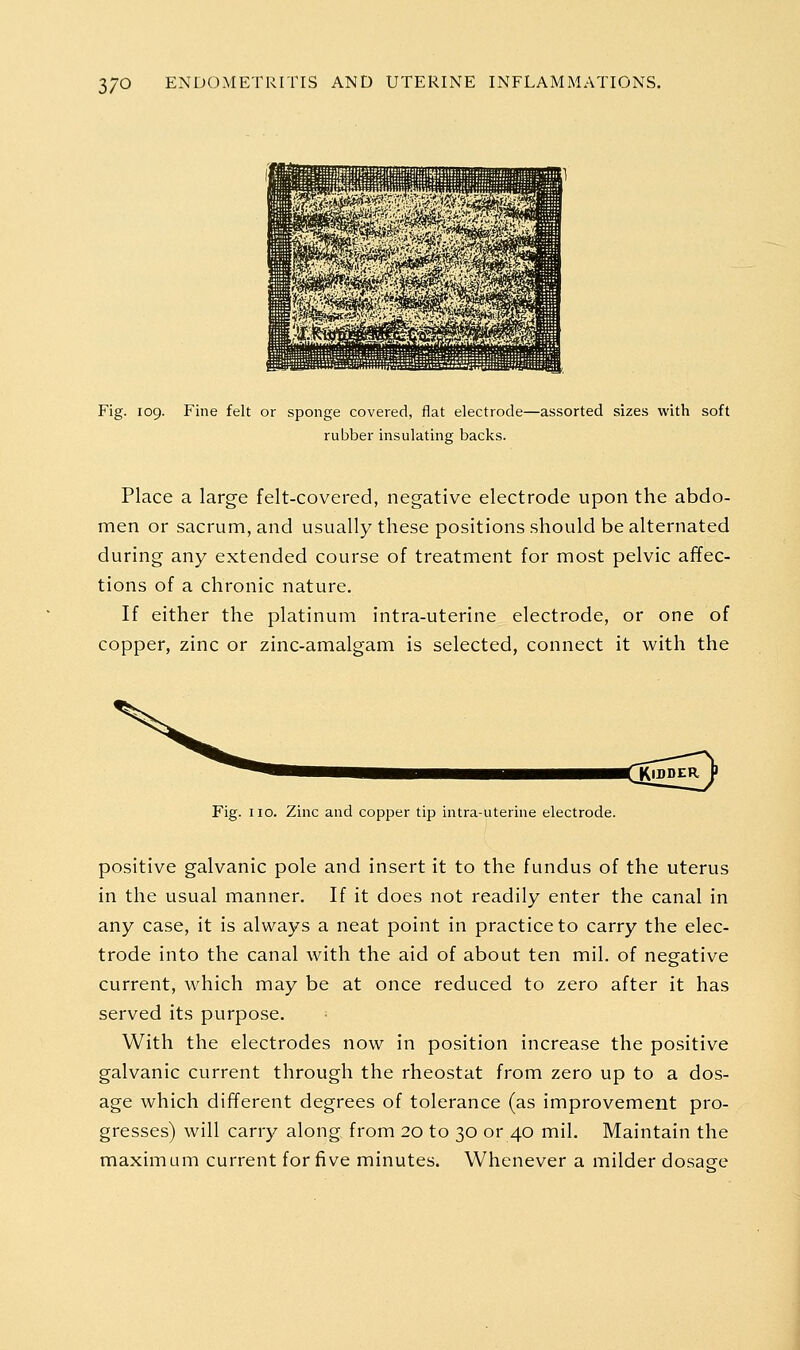 Fig. 109. Fine felt or sponge covered, flat electrode—assorted sizes with soft rubber insulating backs. Place a large felt-covered, negative electrode upon the abdo- men or sacrum, and usually these positions should be alternated during any extended course of treatment for most pelvic affec- tions of a chronic nature. If either the platinum intra-uterine electrode, or one of copper, zinc or zinc-amalgam is selected, connect it with the <[KlBD^ Jj Fig. no. Zinc and copper tip intra-uterine electrode. positive galvanic pole and insert it to the fundus of the uterus in the usual manner. If it does not readily enter the canal in any case, it is always a neat point in practice to carry the elec- trode into the canal with the aid of about ten mil. of negative current, which may be at once reduced to zero after it has served its purpose. ■ With the electrodes now in position increase the positive galvanic current through the rheostat from zero up to a dos- age which different degrees of tolerance (as improvement pro- gresses) will carry along from 20 to 30 or 40 mil. Maintain the maximum current for five minutes. Whenever a milder dosaee