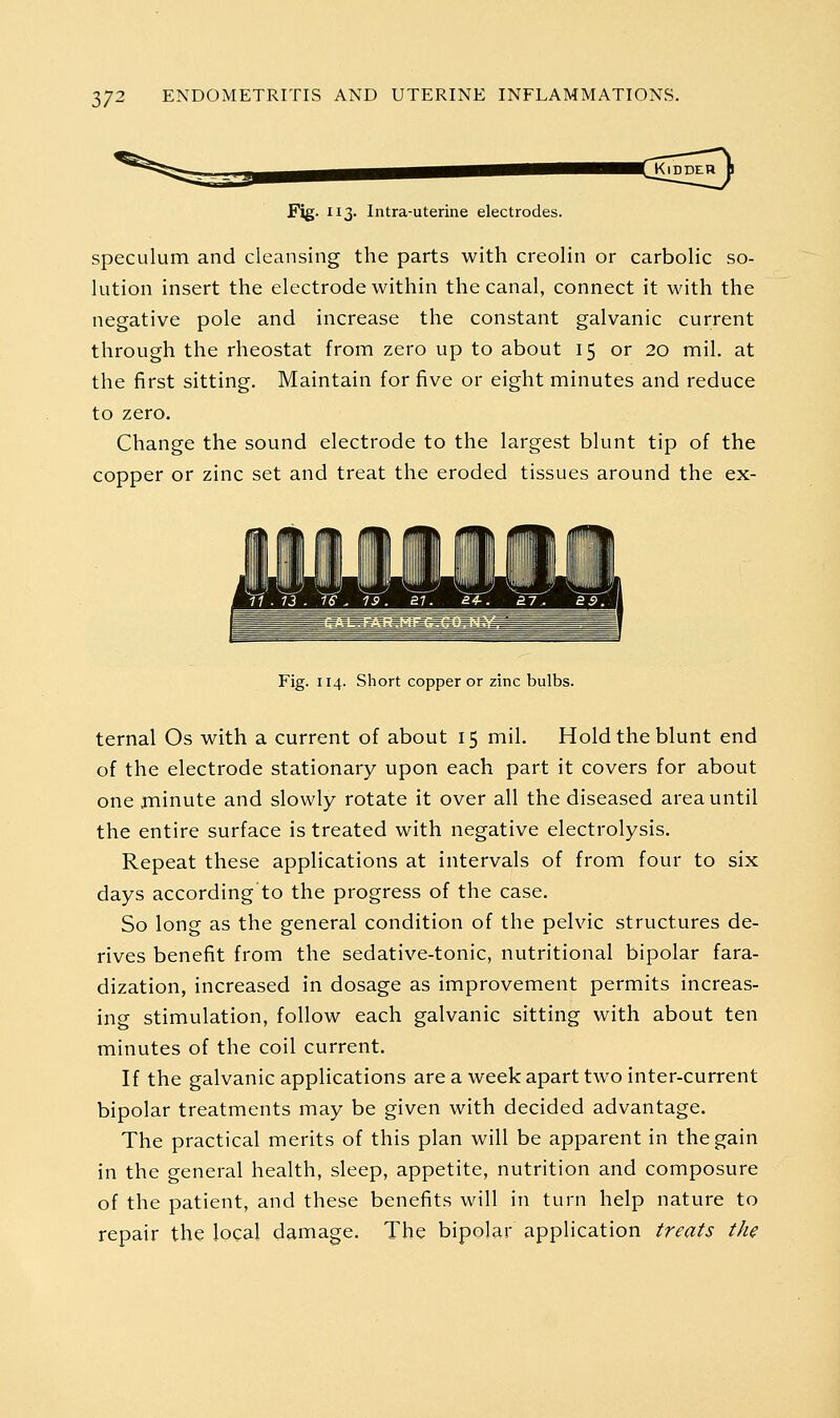 Fig. 113. Intra-uterine electrodes. speculum and cleansing the parts with creolin or carbolic so- lution insert the electrode within the canal, connect it with the negative pole and increase the constant galvanic current through the rheostat from zero up to about 15 or 20 mil. at the first sitting. Maintain for five or eight minutes and reduce to zero. Change the sound electrode to the largest blunt tip of the copper or zinc set and treat the eroded tissues around the ex- .rLLl Fig. 114. Short copper or zinc bulbs. ternal Os with a current of about 15 mil. Hold the blunt end of the electrode stationary upon each part it covers for about one .minute and slowly rotate it over all the diseased area until the entire surface is treated with negative electrolysis. Repeat these applications at intervals of from four to six days according'to the progress of the case. So long as the general condition of the pelvic structures de- rives benefit from the sedative-tonic, nutritional bipolar fara- dization, increased in dosage as improvement permits increas- ing stimulation, follow each galvanic sitting with about ten minutes of the coil current. If the galvanic applications are a week apart two inter-current bipolar treatments may be given with decided advantage. The practical merits of this plan will be apparent in the gain in the general health, sleep, appetite, nutrition and composure of the patient, and these benefits will in turn help nature to repair the local damage. The bipolar application treats the