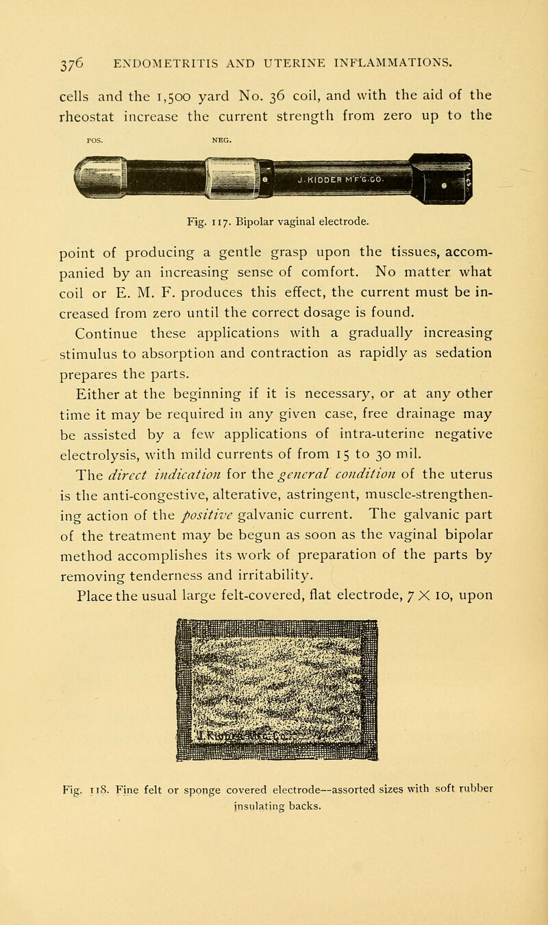 cells and the 1,500 yard No. 36 coil, and with the aid of the rheostat increase the current strength from zero up to the Fig. 117. Bipolar vaginal electrode. point of producing a gentle grasp upon the tissues, accom- panied by an increasing sense of comfort. No matter what coil or E, M. F. produces this effect, the current must be in- creased from zero until the correct dosage is found. Continue these applications with a gradually increasing stimulus to absorption and contraction as rapidly as sedation prepares the parts. Either at the beginning if it is necessary, or at any other time it may be required in any given case, free drainage may be assisted by a few applications of intra-uterine negative electrolysis, with mild currents of from 15 to 30 mil. The direct indication for the general condition of the uterus is the anti-congestive, alterative, astringent, muscle-strengthen- ing action of the positive galvanic current. The galvanic part of the treatment may be begun as soon as the vaginal bipolar method accomplishes its work of preparation of the parts by removing tenderness and irritability. Place the usual large felt-covered, flat electrode, 7X 10, upon Fig. ii8- Fine felt or sponge covered electrode—assorted sizes with soft rubber