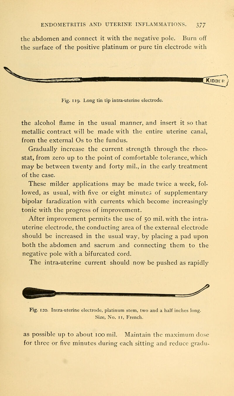 the abdomen and connect it with the negative pole. Burn off the surface of the positive platinum or pure tin electrode with Fig. 119. Long tin lip intra-uterine electrode. the alcohol flame in the usual manner, and insert it so that metallic contract will be made with the entire uterine canal, from the external Os to the fundus. Gradually increase the current strength through the rheo- stat, from zero up to the point of comfortable tolerance, which may be between twenty and forty mil., in the early treatment of the case. These milder applications may be made twice a week, fol- lowed, as usual, with five or eight minutes of supplementary bipolar faradization with currents which become increasingly tonic with the progress of improvement. After improvement permits the use of 50 mil. with the intra- uterine electrode, the conducting area of the external electrode should be increased in the usual way, by placing a pad upon both the abdomen and sacrum .and connecting them to the negative pole with a bifurcated cord. The intra-uterine current should now be pushed as rapidly Fig. 120. Inira-uterine electrode, platinum stem, two and a half inches long. Size, No. II, French. as possible up to about 100 mil. Maintain the maximum dose for three or five minutes during each sitting and reduce gradu-