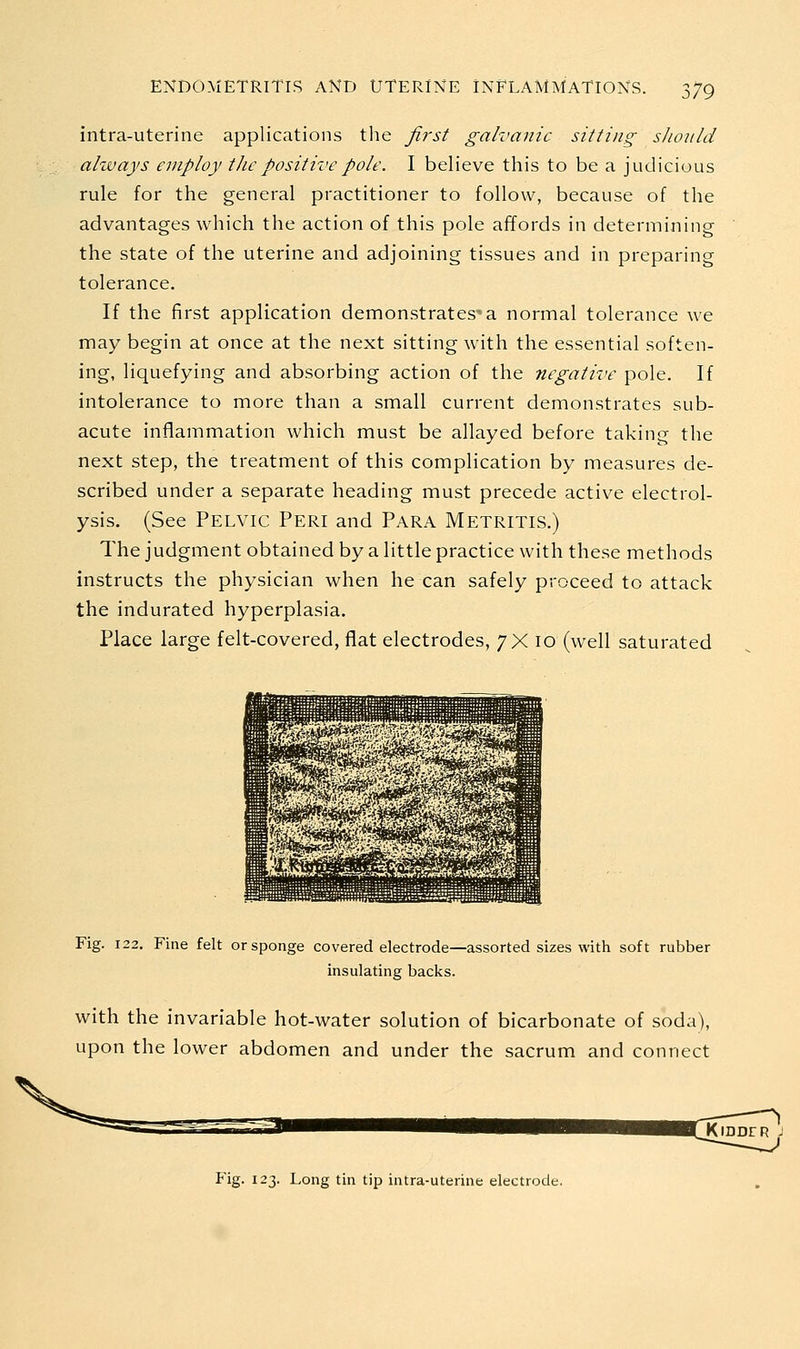 intra-uterine applications tlie first galvanic sitting should always employ tJic positive pole. I believe this to be a judicious rule for the general practitioner to follow, because of the advantages which the action of this pole affords in determining the state of the uterine and adjoining tissues and in preparing tolerance. If the first application demonstrates^ a normal tolerance we may begin at once at the next sitting with the essential soften- ing, liquefying and absorbing action of the negative pole. If intolerance to more than a small current demonstrates sub- acute inflammation which must be allayed before taking the next step, the treatment of this complication by measures de- scribed under a separate heading must precede active electrol- ysis. (See Pelvic Peri and Para Metritis.) The judgment obtained by a little practice with these methods instructs the physician when he can safely proceed to attack the indurated hyperplasia. Place large felt-covered, flat electrodes, 7X 10 (well saturated Fig. 122. Fine felt or sponge covered electrode—assorted sizes with soft rubber insulating backs. with the invariable hot-water solution of bicarbonate of soda), upon the lower abdomen and under the sacrum and connect Fig. 123. Long tin tip intra-uterine electrode.