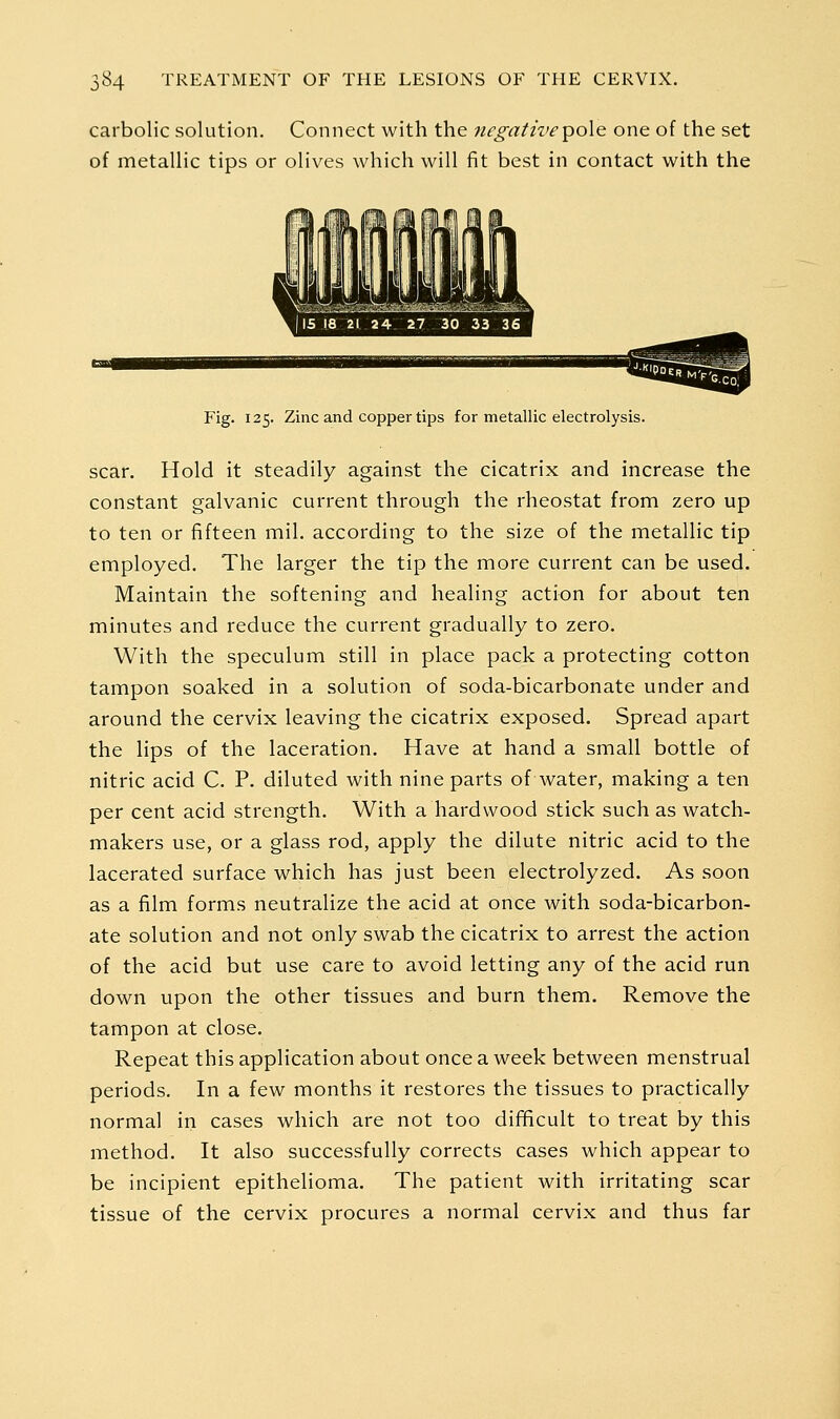 carbolic solution. Connect with the negative^o\q one of the set of metallic tips or olives which will fit best in contact with the Fig. 125. Zinc and copper tips for metallic electrolysis. scar. Hold it steadily against the cicatrix and increase the constant galvanic current through the rheostat from zero up to ten or fifteen mil. according to the size of the metallic tip employed. The larger the tip the more current can be used. Maintain the softening and healing action for about ten minutes and reduce the current gradually to zero. With the speculum still in place pack a protecting cotton tampon soaked in a solution of soda-bicarbonate under and around the cervix leaving the cicatrix exposed. Spread apart the lips of the laceration. Have at hand a small bottle of nitric acid C. P. diluted with nine parts of water, making a ten per cent acid strength. With a hardwood stick such as watch- makers use, or a glass rod, apply the dilute nitric acid to the lacerated surface which has just been electrolyzed. As soon as a film forms neutralize the acid at once with soda-bicarbon- ate solution and not only swab the cicatrix to arrest the action of the acid but use care to avoid letting any of the acid run down upon the other tissues and burn them. Remove the tampon at close. Repeat this application about once a week between menstrual periods. In a few months it restores the tissues to practically normal in cases which are not too difficult to treat by this method. It also successfully corrects cases which appear to be incipient epithelioma. The patient with irritating scar tissue of the cervix procures a normal cervix and thus far