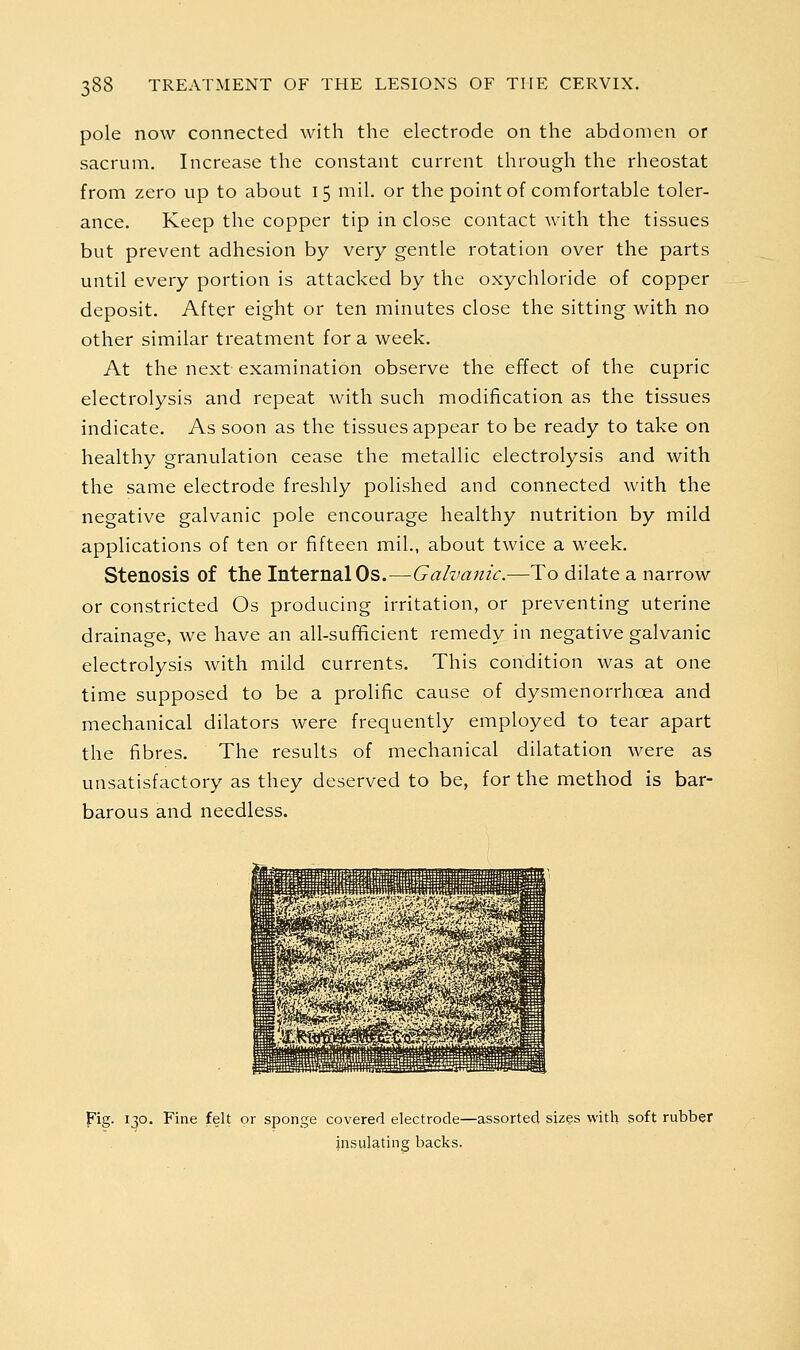 pole now connected with the electrode on the abdomen or sacrum. Increase the constant current through the rheostat from zero up to about 15 mil. or the point of comfortable toler- ance. Keep the copper tip in close contact with the tissues but prevent adhesion by very gentle rotation over the parts until every portion is attacked by the oxychloride of copper deposit. After eight or ten minutes close the sitting with no other similar treatment for a week. At the next examination observe the effect of the cupric electrolysis and repeat with such modification as the tissues indicate. As soon as the tissues appear to be ready to take on healthy granulation cease the metallic electrolysis and with the same electrode freshly polished and connected with the negative galvanic pole encourage healthy nutrition by mild applications of ten or fifteen mil., about twice a week. Stenosis of the Internal Os.—Galvanic.—To dilate a narrow or constricted Os producing irritation, or preventing uterine drainage, we have an all-sufficient remedy in negative galvanic electrolysis with mild currents. This condition was at one time supposed to be a prolific cause of dysmenorrhoea and mechanical dilators were frequently employed to tear apart the fibres. The results of mechanical dilatation were as unsatisfactory as they deserved to be, for the method is bar- barous and needless. pig. 130. Fine felt or sponge covered electrode—assorted sizes with soft rubber insulating backs.