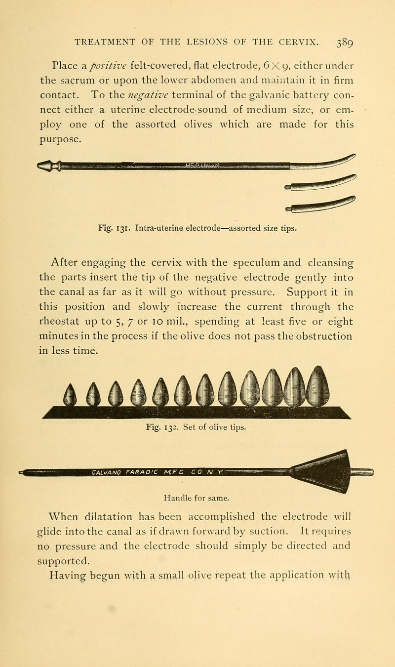 Place 2. positive felt-covered, flat electrode, 6X9, either under the sacrum or upon the lower abdomen and maintain it in firm contact. To the negative terminal of the galvanic battery con- nect either a uterine electrode-sound of medium size, or em- ploy one of the assorted olives which are made for this purpose. Fig. 131. Intra-uterine electrode—assorted size tips. After engaging the cervix with the speculum and cleansing the parts insert the tip of the negative electrode gently into the canal as far as it will go without pressure. Support it in this position and slowly increase the current through the rheostat up to 5, 7 or 10 mil., spending at least five or eight minutes in the process if the olive does not pass the obstruction in less time. Fig. 132. Set of olive tips. Handle for same. When dilatation has been accomplished the electrode will glide into the canal as if drawn forward by suction. It requires no pressure and the electrode should simply be directed and supported. Having begun with a small olive repeat the application with