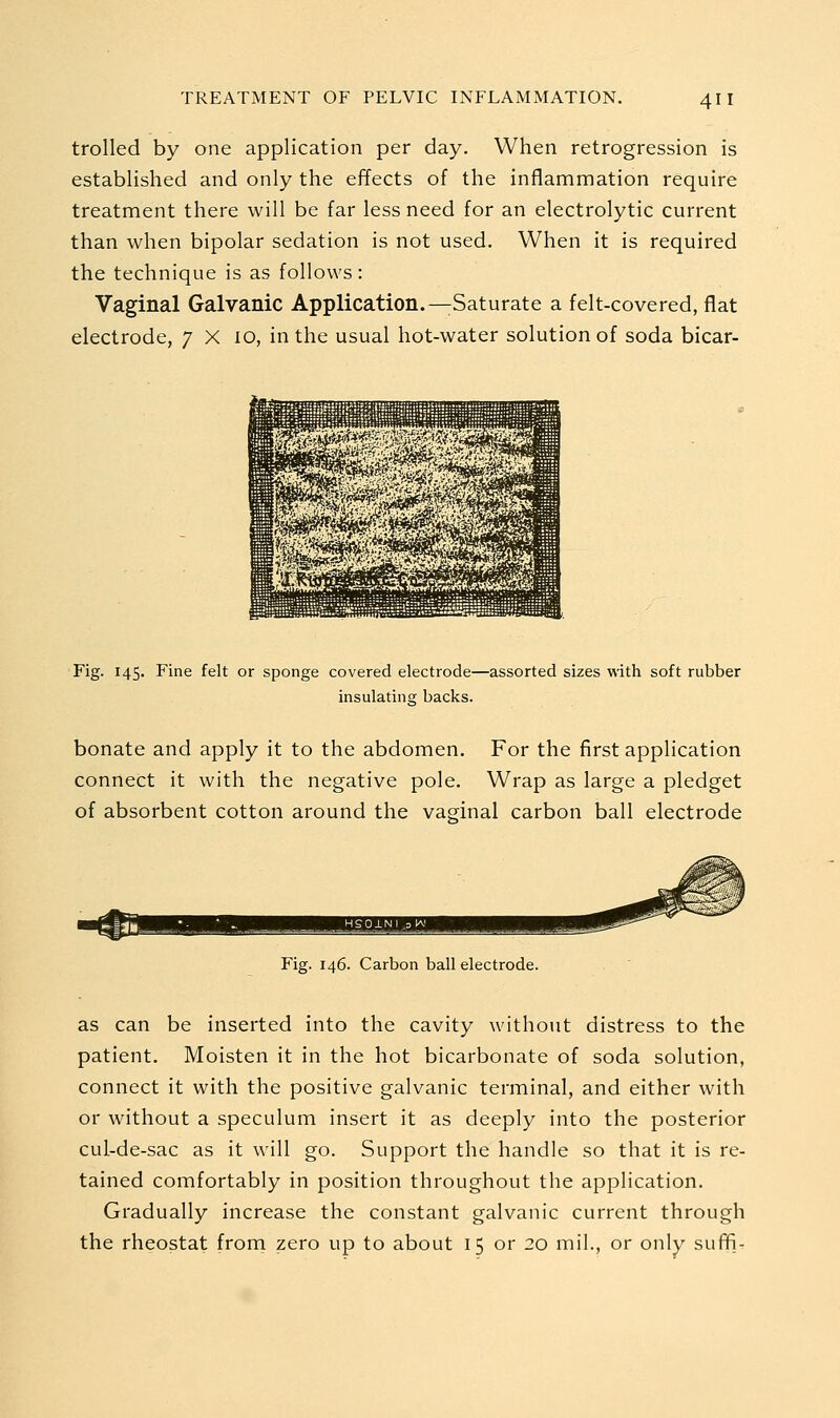 trolled by one application per day. When retrogression is established and only the effects of the inflammation require treatment there will be far less need for an electrolytic current than when bipolar sedation is not used. When it is required the technique is as follows: Vaginal Galvanic Application.—Saturate a felt-covered, flat electrode, 7 X 10, in the usual hot-water solution of soda bicar- Fig. 145. Fine felt or sponge covered electrode—assorted sizes with soft rubber insulating backs. bonate and apply it to the abdomen. For the first application connect it with the negative pole. Wrap as large a pledget of absorbent cotton around the vaginal carbon ball electrode Fig. 146. Carbon ball electrode. as can be inserted into the cavity without distress to the patient. Moisten it in the hot bicarbonate of soda solution, connect it with the positive galvanic terminal, and either with or without a speculum insert it as deeply into the posterior cul-de-sac as it will go. Support the handle so that it is re- tained comfortably in position throughout the application. Gradually increase the constant galvanic current through the rheostat froni zero up to about 15 or 20 mil., or onlv suf^-