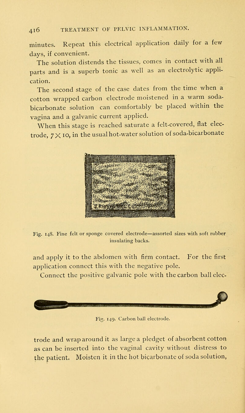 minutes. Repeat this electrical application daily for a few days, if convenient. The solution distends the tissues, comes in contact with all parts and is a superb tonic as well as an electrolytic appli- cation. The second stage of the case dates from the time when a cotton wrapped carbon electrode moistened in a warm soda- bicarbonate solution can comfortably be placed within the vagina and a galvanic current applied. When this stage is reached saturate a felt-covered, flat elec- trode, 7X lO, in the usual hot-water solution of soda-bicarbonate Fig. 148. Fine felt or sponge covered electrode—^^assorted sizes with soft rubber insulating backs. and apply it to the abdomen with firm contact. For the first application connect this with the negative pole. Connect the positive galvanic pole with the carbon ball elec- lMBJl||MyiI^J.llimM!MmjJi||^i^MliM Fig. 149. Carbon ball electrode. trode and wrap around it as large a pledget of absorbent cotton as can be inserted into the vaginal cavity without distress to the patient. Moisten it in the hot bicarbonate of soda solution,