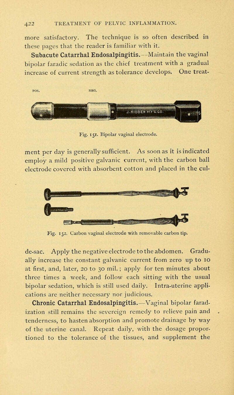 more satisfactory. The technique is so often described in these pages that the reader is famihar with it. Subacute Catarrhal Endosalpingitis.—Maintain the vaginal bipolar faradic sedation as the chief treatment with a gradual increase of current strength as tolerance develops. One treat- Fig. 151. Bipolar vaginal electrode. ment per day is generally sufficient. As soon as it is indicated employ a mild positive galvanic current, with the carbon ball electrode covered with absorbent cotton and placed in the cul- Fig. 152. Carbon vaginal electrode with removable carbon tip. de-sac. Apply the negative electrode to the abdomen. Gradu- ally increase the constant galvanic current from zero up to 10 at first, and, later, 20 to 30 mil.; apply for ten minutes about three times a week, and follow each sitting with the usual bipolar sedation, which is still used daily. Intra-uterine appli- cations are neither necessary nor judicious. Chronic Catarrhal Endosalpingitis.—Vaginal bipolar farad- ization still remains the severeign remedy to relieve pain and tenderness, to hasten absorption and promote drainage by way of the uterine canal. Repeat daily, with the dosage propor- tioned to the tolerance of the tissues, and supplement the