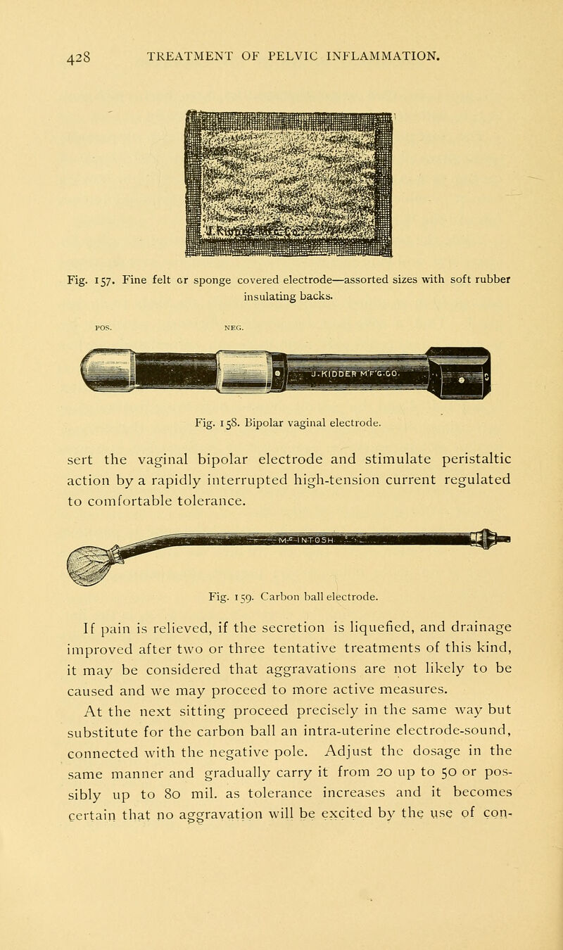 Fig. 157. Fine felt or sponge covered electrode—assorted sizes with soft rubber insulating backs. Fig. 158. Bipolar vaginal electrode. sert the vaginal bipolar electrode and stimulate peristaltic action by a rapidly interrupted high-tension current regulated to comfortable tolerance. Fig. 159. Carbon ball electrode. If pain is relieved, if the secretion is liquefied, and drainage improved after two or three tentative treatments of this kind, it may be considered that aggravations are not likely to be caused and we may proceed to more active measures. At the next sitting proceed precisely in the same way but substitute for the carbon ball an intra-uterine electrode-sound, connected with the negative pole. Adjust the dosage in the same manner and gradually carry it from 20 up to 50 or pos- sibly up to 80 mil. as tolerance increases and it becomes certain that no aggravation will be excited by the use of con-