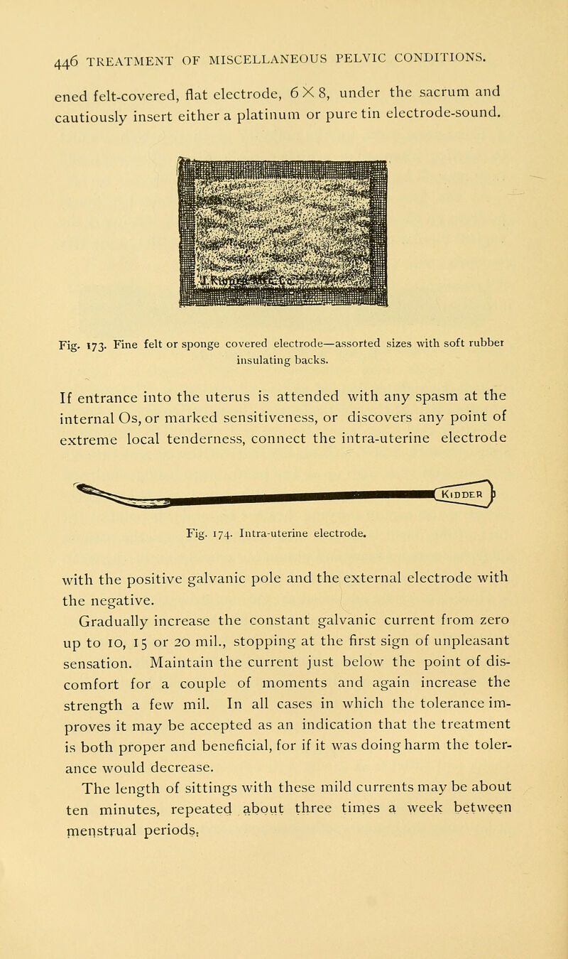 ened felt-covered, flat electrode, 6X8, under the sacrum and cautiously insert either a platinum or pure tin electrode-sound. Fig. 173. Fine felt or sponge covered electrode—assorted sizes with soft rubber insulating backs. If entrance into the uterus is attended with any spasm at the internal Os, or marked sensitiveness, or discovers any point of extreme local tenderness, connect the intra-uterine electrode Fig. 174. Intra-uterine electrode. with the positive galvanic pole and the external electrode with the negative. Gradually increase the constant galvanic current from zero up to 10, 15 or 20 mil., stopping at the first sign of unpleasant sensation. Maintain the current just below the point of dis- comfort for a couple of moments and again increase the strength a few mil. In all cases in which the tolerance im- proves it may be accepted as an indication that the treatment is both proper and beneficial, for if it was doing harm the toler- ance would decrease. The length of sittings with these mild currents may be about ten minutes, repeated about three times a week between pienstrual periods;