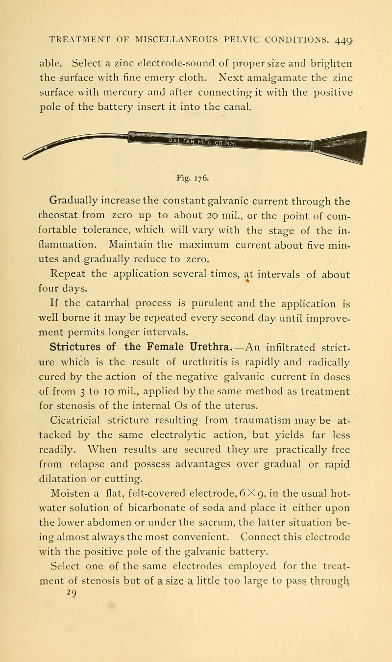 able. Select a zinc electrode-sound of proper size and brighten the surface with fine emery cloth. Next amalgamate the zinc surface with mercury and after connecting it with the positive pole of the battery insert it into the canal. Fig. 176. Gradually increase the constant galvanic current through the rheostat from zero up to about 20 mil., or the point of com- fortable tolerance, which will vary with the stage of the in- flammation. Maintain the maximum current about five min- utes and gradually reduce to zero. Repeat the application several times, at intervals of about four days. If the catarrhal process is purulent and the application is well borne it may be repeated every second day until improve- ment permits longer intervals. Strictures of the Female Urethra.—An infiltrated strict- ure which is the result of urethritis is rapidly and radically cured by the action of the negative galvanic current in doses of from 3 to 10 mil., applied by the same method as treatment for stenosis of the internal Os of the uterus. Cicatricial stricture resulting from traumatism may be at- tacked by the same electrolytic action, but yields far less readily. When results are secured they are practically free from relapse and possess advantages over gradual or rapid dilatation or cutting. Moisten a flat, felt-covered electrode, 6X9, in the usual hot- water solution of bicarbonate of soda and place it either upon the lower abdomen or under the sacrum, the latter situation be- ing almost always the most convenient. Connect this electrode with the positive pole of the galvanic battery. Select one of the same electrodes employed for the treat- ment of stenosis but of a size a, little Xqo large to pass through 29