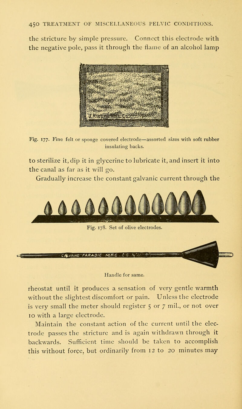 the stricture by simple pressure. Connect this electrode with the negative pole, pass it through the flame of an alcohol lamp Fig. 177. Fine felt or sponge covered electrode—assorted sizes with soft rubber insulating backs. to sterilize it, dip it in glycerine to lubricate it, and insert it into the canal as far as it will go. Gradually increase the constant galvanic current through the Fig. 178. Set of olive electrodes. Handle for same. rheostat until it produces a sensation of very gentle warmth without the slightest discomfort or pain. Unless the electrode is very small the meter should register 5 or 7 mil., or not over 10 with a large electrode. Maintain the constant action of the current until the elec- trode passes the stricture and is again withdrawn through it backwards. Sufficient time should be taken to accomplish this without force, but ordinarily from 12 to 20 minutes may