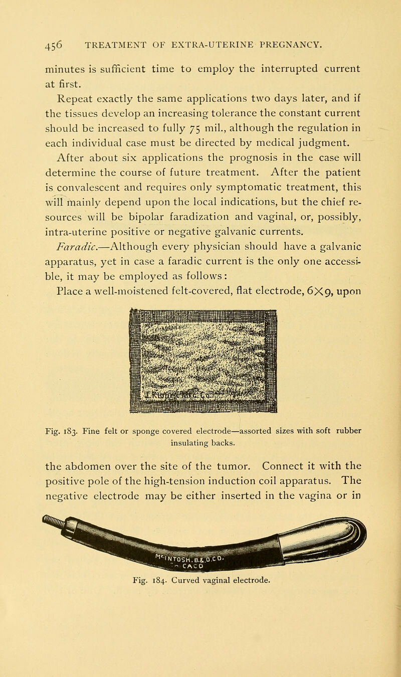 minutes is sufficient time to employ the interrupted current at first. Repeat exactly the same applications two days later, and if the tissues develop an increasing tolerance the constant current should be increased to fully 75 mil., although the regulation in each individual case must be directed by medical judgment. After about six applications the prognosis in the case will determine the course of future treatment. After the patient is convalescent and requires only symptomatic treatment, this will mainly depend upon the local indications, but the chief re- sources will be bipolar faradization and vaginal, or, possibly, intra-uterine positive or negative galvanic currents. Faradic.—Although every physician should have a galvanic apparatus, yet in case a faradic current is the only one accessi- ble, it may be employed as follows: Place a well-moistened felt-covered, flat electrode, 6X9, upon Fig. 183. Fine felt or sponge covered electrode—assorted sizes with soft rubber insulating backs. the abdomen over the site of the tumor. Connect it with the positive pole of the high-tension induction coil apparatus. The negative electrode may be either inserted in the vagina or in Fig. 184. Curved vaginal electrode.