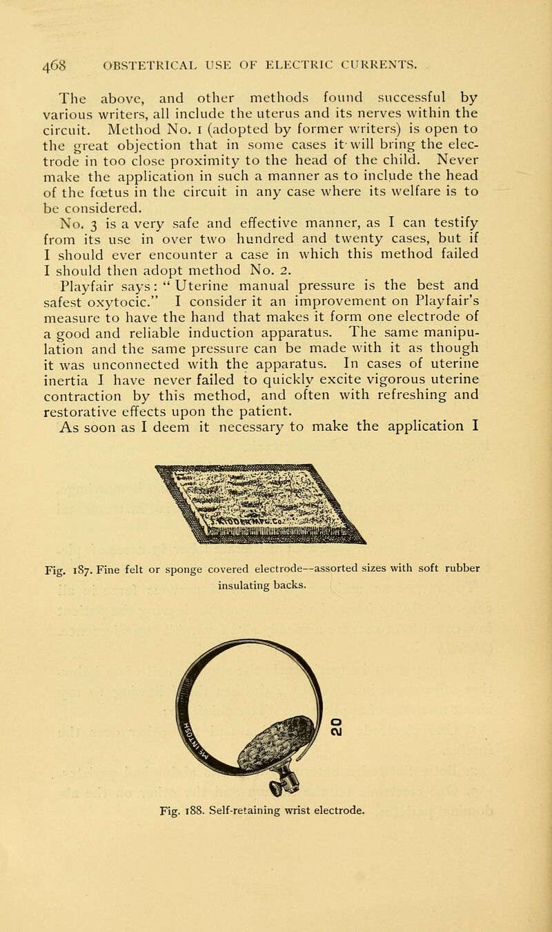 The above, and other methods found successful by various writers, all include the uterus and its nerves within the circuit. Method No. i (adopted by former writers) is open to the great objection that in some cases it-will bring the elec- trode in too close proximity to the head of the child. Never make the application in such a manner as to include the head of the foetus in the circuit in any case where its welfare is to be considered. No. 3 is a very safe and effective manner, as I can testify from its use in over two hundred and twenty cases, but if I should ever encounter a case in which this method failed I should then adopt method No. 2. Playfair says:  Uterine manual pressure is the best and safest oxytocic. I consider it an improvement on Playfair's measure to have the hand that makes it form one electrode of a good and reliable induction apparatus. The same manipu- lation and the same pressure can be made with it as though it was unconnected with the apparatus. In cases of uterine inertia I have never failed to quickly excite vigorous uterine contraction by this method, and often with refreshing and restorative efTects upon the patient. As soon as I deem it necessary to make the application I Fig. 187. Fine felt or sponge covered electrode—assorted sizes with soft rubber insulating backs. Fig. 188. Self-retaining wrist electrode.