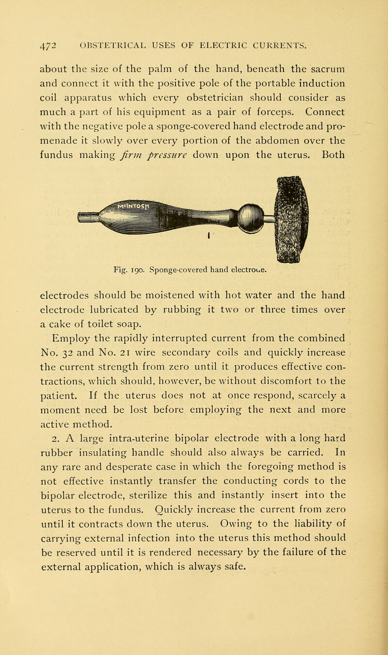 about the size of the pahn of the hand, beneath the sacrum and connect it with the positive pole of the portable induction coil apparatus which every obstetrician should consider as much a part of his equipment as a pair of forceps. Connect with the negative pole a sponge-covered hand electrode and pro- menade it slowly over every portion of the abdomen over the fundus making firm pressure down upon the uterus. Both Fig. 190. Sponge-covered hand electroue. electrodes should be moistened with hot water and the hand electrode lubricated by rubbing it two or three times over a cake of toilet soap. Employ the rapidly interrupted current from the combined No. 32 and No. 21 wire secondary coils and quickly increase the current strength from zero until it produces effective con- tractions, which should, however, be without discomfort to the patient. If the uterus does not at once respond, scarcely a moment need be lost before employing the next and more active method. 2. A large intra-uterine bipolar electrode with a long hard rubber insulating handle should also always be carried. In any rare and desperate case in which the foregoing method is not effective instantly transfer the conducting cords to the bipolar electrode, sterilize this and instantly insert into the uterus to the fundus. Quickly increase the current from zero until it contracts down the uterus. Owing to the liability of carrying external infection into the uterus this method should be reserved until it is rendered necessary by the failure of the external application, which is always safe.