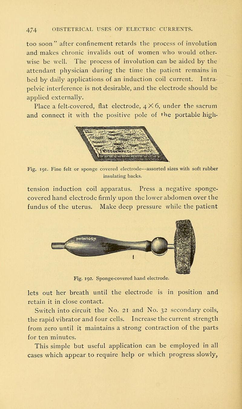 too soon after confinement retards the process of involution and makes chronic invahds out of women who would other- wise be well. The process of involution can be aided by the attendant physician during the time the patient remains in bed by daily applications of an induction coil current. Intra- pelvic interference is not desirable, and the electrode should be applied externally. Place a felt-covered, flat electrode, 4X6, under the sacrum and connect it with the positive pole of the portable high- Fig. 191. Fine felt or sponge covered electrode—assorted sizes with soft rubber insulating backs. tension induction coil apparatus. Press a negative sponge- covered hand electrode firmly upon the lower abdomen over the fundus of the uterus. Make deep pressure while the patient Fig. 192. Sponge-covered hand electrode. lets out her breath until the electrode is in position and retain it in close contact. Switch into circuit the No. 21 and No. 32 secondary coils, the rapid vibrator and four cells. Increase the current strength from zero until it maintains a strong contraction of the parts for ten minutes. This simple but useful application can be employed in all cases which appear to require help or which progress slowly,