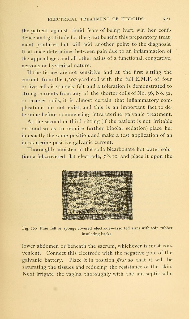 the patient against timid fears of being hurt, win her confi- dence and gratitude for the great benefit this preparatory treat- ment produces, but will add another point to the diagnosis. It at once determines between pain due to an inflammation of the appendages and all other pains of a functional, congestive, nervous or hysterical nature. If the tissues are not sensitive and at the first sitting the current from the 1,500 yard coil with the full E.M.F. of four or five cells is scarcely felt and a toleration is demonstrated to strong currents from any of the shorter coils of No. 36, No, 32, or coarser coils, it is almost certain that inflammatory com- plications do not exist, and this is an important fact to de- termine before commencing intra-uterine galvanic treatment. At the second or third sitting (if the patient is not irritable or timid so as to require further bipolar sedation) place her in exactly the same position, and make a test application of an intra-uterine positive galvanic current. Thoroughly moisten in the soda bicarbonate hot-water solu- tion a felt-covered, flat electrode, 7X 10, and place it upon the Fig. 206. Fine felt or sponge covered electrode—assorted sizes with soft rubber insulating backs. lower abdomen or beneath the sacrum, whichever is most con- venient. Connect this electrode with the negative pole of the galvanic battery. Place it in position first so that it will be saturating the tissues and reducing the resistance of the skin. Next irrigate the vagina thoroughly with the antiseptic solu-