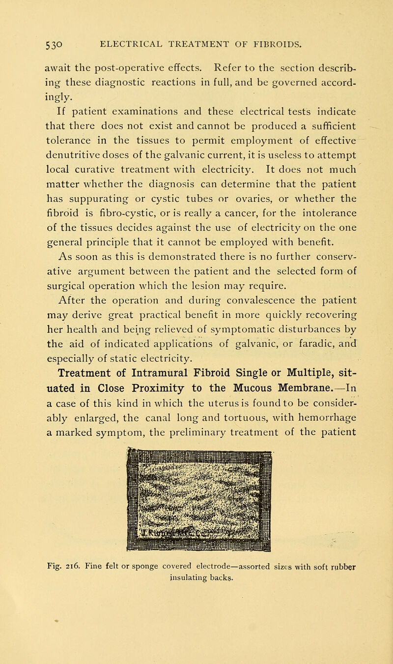 await the post-operative effects. Refer to the section describ- ing these diagnostic reactions in full, and be governed accord- ingly. If patient examinations and these electrical tests indicate that there does not exist and cannot be produced a sufficient tolerance in the tissues to permit employment of effective denutritive doses of the galvanic current, it is useless to attempt local curative treatment with electricity. It does not much matter whether the diagnosis can determine that the patient has suppurating or cystic tubes or ovaries, or whether the fibroid is fibro-cystic, or is really a cancer, for the intolerance of the tissues decides against the use of electricity on the one general principle that it cannot be employed with benefit. As soon as this is demonstrated there is no further conserv- ative argument between the patient and the selected form of surgical operation which the lesion may require. After the operation and during convalescence the patient may derive great practical benefit in more quickly recovering her health and being relieved of symptomatic disturbances by the aid of indicated applications of galvanic, or faradic, and especially of static electricity. Treatment of Intramural Fibroid Single or Multiple, sit- uated in Close Proximity to the Mucous Membrane.—In a case of this kind in which the uterus is found to be consider- ably enlarged, the canal long and tortuous, with hemorrhage a marked symptom, the preliminary treatment of the patient Fig. 2i6. Fine felt or sponge covered electrode—assorted sizes with soft rubber insulating backs.