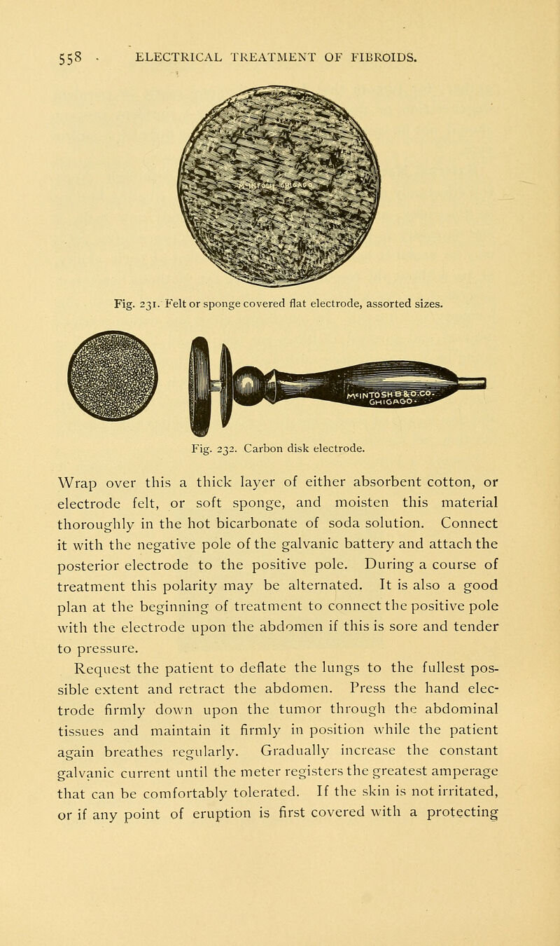 Fig. 231. Felt or sponge covered flat electrode, assorted sizes. Carbon disk electrode. Wrap over this a thick layer of either absorbent cotton, or electrode felt, or soft sponge, and moisten this material thoroughly in the hot bicarbonate of soda solution. Connect it with the negative pole of the galvanic battery and attach the posterior electrode to the positive pole. During a course of treatment this polarity may be alternated. It is also a good plan at the beginning of treatment to connect the positive pole with the electrode upon the abdomen if this is sore and tender to pressure. Request the patient to deflate the lungs to the fullest pos- sible extent and retract the abdomen. Press the hand elec- trode firmly down upon the tumor through the abdominal tissues and maintain it firmly in position while the patient again breathes regularly. Gradually increase the constant galvanic current until the meter registers the greatest amperage that can be comfortably tolerated. If the skin is not irritated, or if any point of eruption is first covered with a protecting