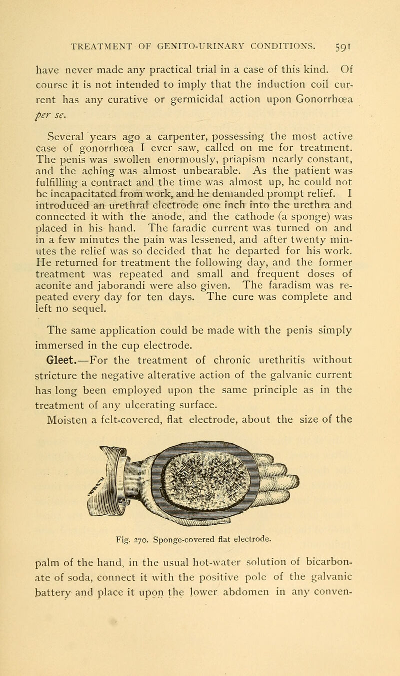 have never made any practical trial in a case of this kind. Of course it is not intended to imply that the induction coil cur- rent has any curative or germicidal action upon Gonorrhoea per se. Several years ago a carpenter, possessing the most active case of gonorrhoea I ever saw, called on me for treatment. The penis was swollen enormously, priapism nearly constant, and the aching was almost unbearable. As the patient was fulfilling a contract and the time was almost up, he could not be incapacitated from work, and he demanded prompt relief. I introduced an urethral electrode one inch into the urethra and connected it with the anode, and the cathode (a sponge) was placed in his hand. The faradic current was turned on and in a few minutes the pain was lessened, and after twenty min- utes the relief was so decided that he departed for his work. He returned for treatment the following day, and the former treatment was repeated and small and frequent doses of aconite and jaborandi were also given. The faradism was re- peated every day for ten days. The cure was complete and left no sequel. The same application could be made with the penis simply immersed in the cup electrode. Gleet.—For the treatment of chronic urethritis without stricture the negative alterative action of the galvanic current has long been employed upon the same principle as in the treatment of any ulcerating surface. Moisten a felt-covered, flat electrode, about the size of the Fig. 270. Sponge-covered flat electrode. palm of the hand^ in the usual hot-water solution of bicarbon- ate of soda, connect it with the positive pole of the galvanic battery and place it upon the lower abdomen in any conven-