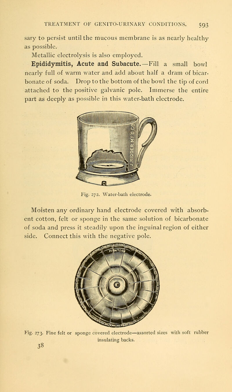 sary to persist until the mucous membrane is as nearly healthy as possible. Metallic electrolysis is also employed. Epididymitis, Acute and Subacute.—Fill a small bowl nearly full of warm water and add about half a dram of bicar- bonate of soda. Drop to the bottom of the bowl the tip of cord attached to the positive galvanic pole. Immerse the entire part as deeply as possible in this water-bath electrode. Fig. 272. Waler-bath electrode. Moisten any ordinary hand electrode covered with absorb- ent cotton, felt or sponge in the same solution of bicarbonate of soda and press it steadily upon the inguinal region of either side. Connect this with the negative pole. I'ig- 273. Fine felt or sponge covered electrode—assorted sizes with soft rubber insulating backs. 38