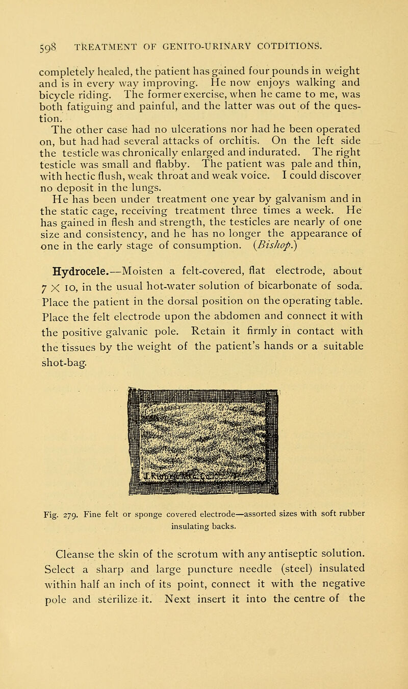 completely healed, the patient has gained four pounds in weight and is in every way improving. He now enjoys walking and bicycle riding. The former exercise, when he came to me, was both fatiguing and painful, and the latter was out of the ques- tion. The other case had no ulcerations nor had he been operated on, but had had several attacks of orchitis. On the left side the testicle was chronically enlarged and indurated. The right testicle was small and fliabby. The patient was pale and thin, with hectic flush, weak throat and weak voice. I could discover no deposit in the lungs. He has been under treatment one year by galvanism and in the static cage, receiving treatment three times a week. He has gained in flesh and strength, the testicles are nearly of one size and consistency, and he has no longer the appearance of one in the early stage of consumption. {Bishop^ Hydrocele.—Moisten a felt-covered, flat electrode, about 7 X lo, in the usual hot-water solution of bicarbonate of soda. Place the patient in the dorsal position on the operating table. Place the felt electrode upon the abdomen and connect it with the positive galvanic pole. Retain it firmly in contact with the tissues by the weight of the patient's hands or a suitable shot-bag. Fig. 279. Fine felt or sponge covered electrode—assorted sizes with soft rubber insulating backs. Cleanse the skin of the scrotum with any antiseptic solution. Select a sharp and large puncture needle (steel) insulated within half an inch of its point, connect it with the negative pole and sterilize it. Next insert it into the centre of the