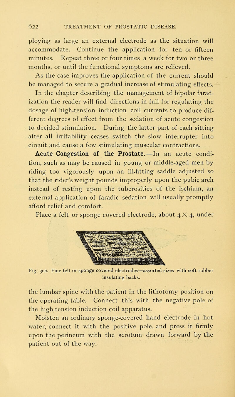 ploying as large an external electrode as the situation will accommodate. Continue the application for ten or fifteen minutes. Repeat three or four times a week for two or three months, or until the functional symptoms are relieved. As the case improves the application of the current should be managed to secure a gradual increase of stimulating effects. In the chapter describing the management of bipolar farad- ization the reader will find directions in full for regulating the dosage of high-tension induction coil currents to produce dif- ferent degrees of effect from the sedation of acute congestion to decided stimulation. During the latter part of each sitting after all irritability ceases switch the slow interrupter into circuit and cause a few stimulating muscular contractions. Acute Congestion of the Prostate.—In an acute condi- tion, such as may be caused in young or middle-aged men by riding too vigorously upon an ill-fitting saddle adjusted so that the rider's weight pounds improperly upon the pubic arch instead of resting upon the tuberosities of the ischium, an external application of faradic sedation will usually promptly afford relief and comfort. Place a felt or sponge covered electrode, about 4X4, under Fig. 300. Fine felt or sponge covered electrodes—assorted sizes with soft rubber insulating backs. the lumbar spine with the patient in the lithotomy position on the operating table. Connect this with the negative pole of the high-tension induction coil apparatus. Moisten an ordinary sponge-covered hand electrode in hot Avater, connect it with the positive pole, and press it firmly upon the perineum with the scrotum drawn forward by the patient out of the way.