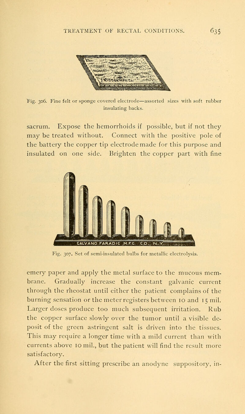 Fig. 306. Fine felt or sponge covered electrode—assorted sizes with soft rubber insulating backs. sacrum. Expose the hemorrhoids if possible, but if not they may be treated without. Connect with the positive pole of the battery the copper tip electrode made for this purpose and insulated on one side. Brighten the copper part with fine Fig. 307. Set of semi-insulated bulbs for metallic electrolysis. emery paper and apply the metal surface to the mucous mem- brane. Gradually increase the constant galvanic current through the rheostat until either the patient complains of the burning sensation or the meter registers between 10 and 15 mil. Larger doses produce too much subsequent irritation. Rub the copper surface slowly over the tumor until a visible de- posit of the green astringent salt is driven into the tissues. This may require a longer time with a mild current than with currents above 10 mil., but the patient will find the result more satisfactory. After the first sitting prescribe an anodyne suppository, in-