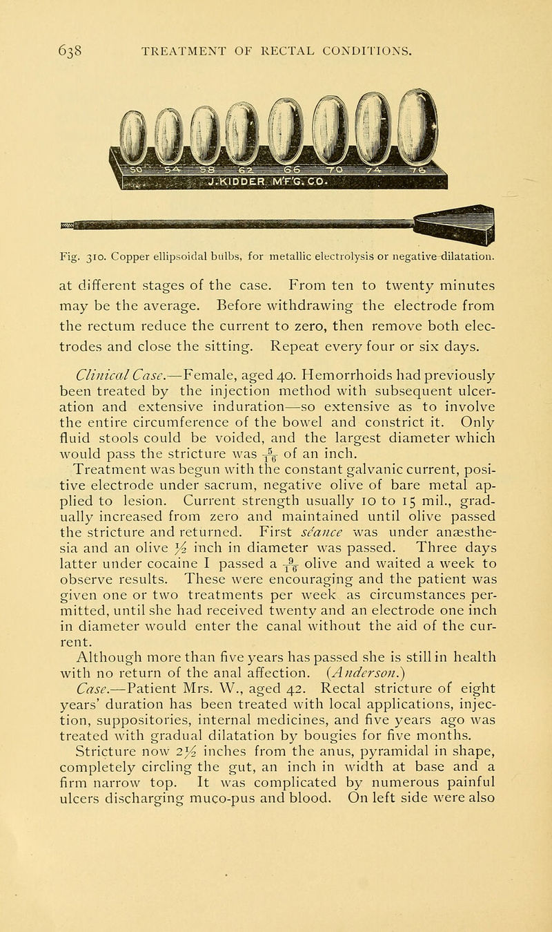 Fig. 310. Copper ellipsoidal bulbs, for metallic electrolysis or negative dilatation. at different stages of the case. From ten to twenty minutes may be the average. Before withdrawing the electrode from the rectum reduce the current to zero, then remove both elec- trodes and close the sitting. Repeat every four or six days. Clinical Case.—Female, aged 40. Hemorrhoids had previously been treated by the injection method with subsequent ulcer- ation and extensive induration—so extensive as to involve the entire circumference of the bowel and constrict it. Only fluid stools could be voided, and the largest diameter which would pass the stricture was -^ of an inch. Treatment was begun with the constant galvanic current, posi- tive electrode under sacrum, negative olive of bare metal ap- plied to lesion. Current strength usually 10 to 15 mil., grad- ually increased from zero and maintained until olive passed the stricture and returned. First seance was under anaesthe- sia and an olive ^ inch in diameter was passed. Three days latter under cocaine I passed a -^^ olive and waited a week to observe results. These were encouraging and the patient was given one or two treatments per week as circumstances per- mitted, until she had received twenty and an electrode one inch in diameter would enter the canal without the aid of the cur- rent. Although more than five years has passed she is still in health with no return of the anal affection. {Anderson}) Case.—Patient Mrs. W., aged 42. Rectal stricture of eight years' duration has been treated with local applications, injec- tion, suppositories, internal medicines, and five years ago was treated with gradual dilatation by bougies for five months. Stricture now 2^ inches from the anus, pyramidal in shape, completely circling the gut, an inch in width at base and a firm narrow top. It was complicated by numerous painful ulcers discharging muco-pus and blood. On left side were also