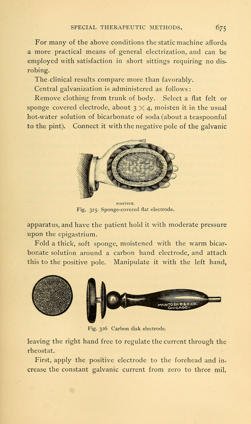 For many of the above conditions the static machine affords a more practical means of general electrization, and can be employed with satisfaction in short sittings requiring no dis- robing. The.clinical results compare more than favorably. Central galvanization is administered as follows: Remove clothing from trunk of body. Select a flat felt or sponge covered electrode, about 3X4, moisten it in the usual hot-water solution of bicarbonate of soda (about a teaspoonful to the pint). Connect it with the negative pole of the galvanic POSITIVE. Fig. 325. Sponge-covered flat electrode. apparatus, and have the patient hold it with moderate pressure upon the epigastrium. Fold a thick, soft sponge, moistened with the warm bicar- bonate solution around a carbon hand electrode, and attach this to the positive pole. Manipulate it with the left hand, Fig. 326 Carbon disk electrode. leaving the right hand free to regulate the current through the rheostat. First, apply the positive electrode to the forehead and in- crease the constant galvanic current from zero to three mil.