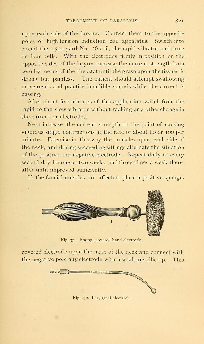 upon each side of the larynx. Connect them to the opposite poles of high-tension induction coil apparatus. Switch into circuit the 1,500 yard No. 36 coil, the rapid vibrator and three or four cells. With the electrodes firmly in position on the opposite sides of the larynx increase the current strength from zero by means of the rheostat until the grasp upon the tissues is strong but painless. The patient should attempt swallowing movements and practise inaudible sounds while the current is passing. After about five minutes of this application switch from the rapid to the slow vibrator without making any other change in the current or electrodes. Next increase the current strength to the point of causing vigorous single contractions at the rate of about 80 or 100 per minute. Exercise in this way the muscles upon each side of the neck, and during succeeding sittings alternate the situation of the positive and negative electrode. Repeat daily or every second day for one or two weeks, and three times a week there- after until improved sufficiently. If the faucial muscles are affected, place a positive sponge- Fig. 371. Sponge-covered hand electrode. covered electrode upon the nape of the neck and connect with the negative pole any electrode with a small metallic tip. This Fig. 372. Laryngeal electrode.