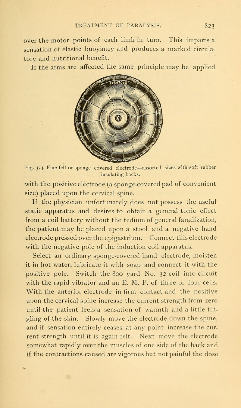 over the motor points of each limb in turn. This imparts a sensation of elastic buoyancy and produces a marked circula- tory and nutritional benefit. If the arms are affected the same principle may be applied Fig- 374- Fine felt or sponge covered electrode—assorted sizes with soft rubber insulating backs. with the positive electrode (a sponge-covered pad of convenient size) placed upon the cervical spine. If the physician unfortunately does not possess the useful static apparatus and desires to obtain a general tonic effect from a coil battery without the tedium of general faradization, the patient may be placed upon a stool and a negative hand electrode pressed over the epigastrium. Connect this electrode with the negative, pole of the induction coil apparatus. Select an ordinary sponge-covered hand electrode, moisten it in hot water, lubricate it with soap and connect it with the positive pole. Switch the 800 yard No. 32 coil into circuit with the rapid vibrator and an E. M. F. of three or four cells. With the anterior electrode in firm contact and the positive upon the cervical spine increase the current strength from zero until the patient feels a sensation of warmth and a little tin- gling of the skin. Slowly move the electrode down the spine, and if sensation entirely ceases at any point increase the cur- rent strength until it is again felt. Next move the electrode somewhat rapidly over the muscles of one side of the back and if the contractions caused are vigorous but not painful the dose
