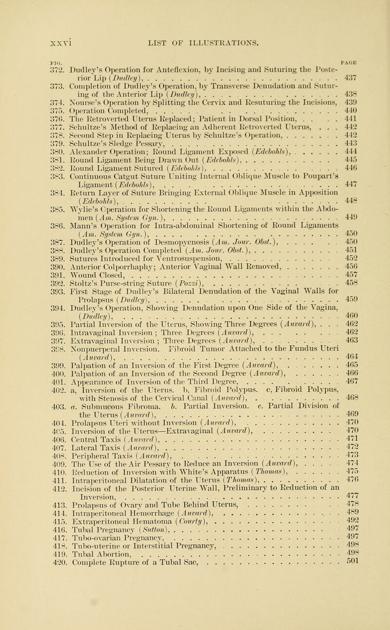 FIG. PAGE 372. Dudley's Operation for Anteflexion, by Incising and Suturing the Poste- rior Lip (Dudley), 437 373. Completion of Dudley's Operation, by Transverse Denudation and Sutur- ing of the Anterior Lip (Dudley), 438 374. Nourse's Operation by Splitting the Cervix and Eesuturing the Incisions, 439 375. Operation Completed, 440 376. The Eetroverted Uterus Replaced; Patient in Dorsal Position, . . . . 441 377. Schultze's Method of Replacing an Adherent Retroverted Uterus, . . . 442 378. Second Step in Replacing Uterus by Schultze's Operation, 442 379. Schultze's Sledge Pessary, 443 380. Alexander Operation; Round Ligament Exposed (Edebohls), 444 381. Round Ligament Being Drawn Out (Edebohls), 445 382. Round Ligament Sutured (Edebohls), 446 383. Continuous Catgut Suture Uniting Internal Oblique Muscle to Poupart's Ligament (Edebohls), 447 384. Return Layer of Suture Bringing External Oblique Muscle in Apposition (Edebohls), 448 385. Wylie's Operation for Shortening the Eound Ligaments within the Abdo- men (Am. System Gyn.), 449 386. Mann's Operation for Intra-abdominal Shortening of Eound Ligaments (Am. System Gyn.), 450 387. Dudley's Operation of Desmopycnosis (Am. Jour. Obst.), 450 388. Dudley's Operation Completed (Am. Jour. Obst.), 451 389. Sutures Introduced for Ventrosuspension, 452 390. Anterior Colporrhaphy; Anterior Vaginal Wall Eemoved, 456 391. Wound Closed, 457 392. Stoltz's Purse-string Suture (Pozzi), ... 458 393. First Stage of Dudley's Bilateral Denudation of the Vaginal Walls for Prolapsus (Dudley), 459 394. Dudley's Operation, Showing Denudation upon One Side of the Vagina, (Dudley), 460 395. Partial Inversion of the Uterus, Showing Three Degrees (Auvard), . . . 462 396. Intra vaginal Inversion ; Three Degrees (Auvard), 462 397. Extra vaginal Inversion ; Three Degrees (Auvard), 463 398. Nonpuerperal Inversion. Fibroid Tumor Attached to the Fundus Uteri (Auvard), 464 399. Palpation oi' an Inversion of the First Degree (Auvard), 465 400. Palpation of an Inversion of the Second Degree (Auvard), 466 401. Appearance of Inversion of the Third Degree, 467 402. a, Inversion of the Uterus, b, Fibroid Polypus, c, Fibroid Polypus, with Stenosis of the Cervical Canal (Auvard), . 468 403. a. Submucous Fibroma, b. Partial Inversion, c. Partial Division of the Uterus (Auvard), 469 404. Prolapsus Uteri without Inversion (^4uvard), 470 4C5. Inversion of the Uterus—Extravaginal (Auvard), 470 406. Central Taxis (Auvard), 471 407. Lateral Taxis (Auvard), 472 408. Peripheral Taxis (Auvard), . - 473 409. The Use of the Air Pessary to Eeduce an Inversion (Auvard), 474 410. Reduction of Inversion with White's Apparatus (Thomas), 475 411. Intraperitoneal Dilatation of the Uterus (Thomas), 476 412. Incision of the Posterior Uterine Wall, Preliminary to Eeduction of an Inversion, 477 413. Prolapsus of Ovary and Tube Behind Uterus, . . 478 414. Intraperitoneal Hemorrhage (Auvard), • . 489 415. Extraperitoneal Hematoma (Courty), 492 416. Tubal Pregnancy (Sutton), 497 417. Tubo-ovarian Pregnancy, 497 418. Tubo-uterine or Interstitial Pregnancv, 498 419. Tubal Abortion, 498 420. Complete Eupture of a Tubal Sac, 501