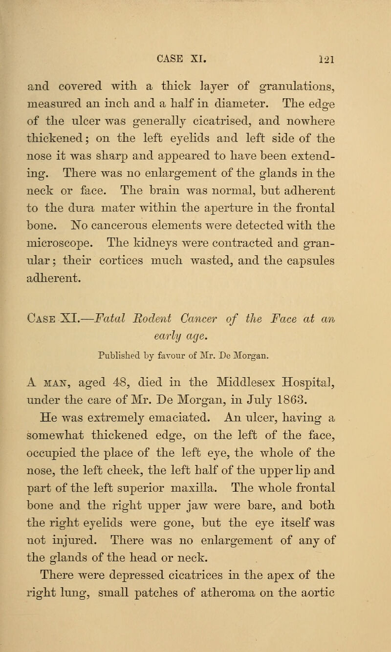 and covered witli a thick layer of granulations, measured an inch and a half in diameter. The edge of the ulcer was generally cicatrised, and nowhere thickened; on the left eyelids and left side of the nose it was sharp and appeared to have been extend- ing. There was no enlargement of the glands in the neck or face. The brain was normal, but adherent to the dura mater within the aperture in the frontal bone. ISTo cancerous elements were detected with the microscope. The kidneys were contracted and gran- ular ; their cortices much wasted, and the capsules adherent. Case XI.—Fatal Rodent Cancer of the Face at an early age. Published by favour of Mr. De Morgan. A MAN, aged 48, died in the Middlesex Hospital, under the care of Mr. De Morgan, in July 1863. He was extremely emaciated. An ulcer, having a somewhat thickened edge, on the left of the face, occupied the place of the left eye, the whole of the nose, the left cheek, the left half of the upper lip and part of the left superior maxilla. The whole frontal bone and the right upper jaw were bare, and both the right eyelids were gone, but the eye itself was not injured. There was no enlargement of any of the glands of the head or neck. There were depressed cicatrices in the apex of the right lung, small patches of atheroma on the aortic