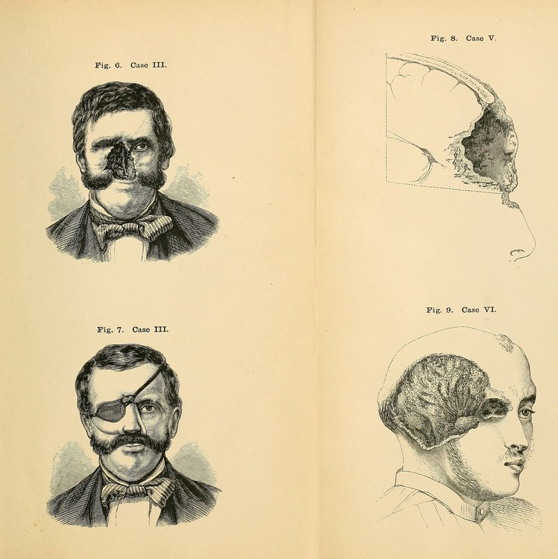 Fig. 6. Case III. Fig. 9. Case VI. Fig. 7. Case III.