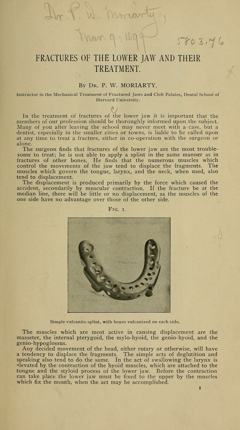 iv xo/ruA 5To l^U FRACTURES OF THE LOWER JAW AND THEIR TREATMENT. By Dr. P. W. MORIARTY. Instructor in the Mechanical Treatment of Fractured Jaws and Cleft Palates, Dental School of Harvard University. In the treatment of fractures of the lower jaw it is important that the members of our profession should be thoroughly informed upon the subject. Many of you after leaving the school may never meet with a case, but a dentist, especially in the smaller cities or towns, is liable to be called upon at any time to treat a fracture, either in co-operation with the surgeon or alone. The surgeon finds that fractures of the lower jaw are the most trouble- some to treat; he is not able to apply a splint in the same manner as in fractures of other bones. He finds that the numerous muscles which control the movements of the jaw tend to displace the fragments. The muscles which govern the tongue, larynx, and the neck, when used, also tend to displacement. The displacement is produced primarily by the force which caused the accident, secondarily by muscular contraction. If the fracture be at the median line, there will be little or no displacement, as the muscles of the one side have no advantage over those of the other side. Fig. i. Simple vulcanite splint, with boxes vulcanized on each side. The muscles which are most active in causing displacement are the masseter, the internal pterygoid, the mylo-hyoid, the genio-hyoid, and the genio-hypoglossus. Any decided movement of the head, either rotary or otherwise, will have a tendency to displace the fragments. The simple acts of deglutition and speaking also tend to do the same. In the act of swallowing the larynx is elevated by the contraction of the hyoid muscles, which are attached to the tongue and the styloid process of the lower jaw. Before the contraction can take place the lower jaw must be fixed to the upper by the muscles which fix the mouth, when the act may be accomplished.